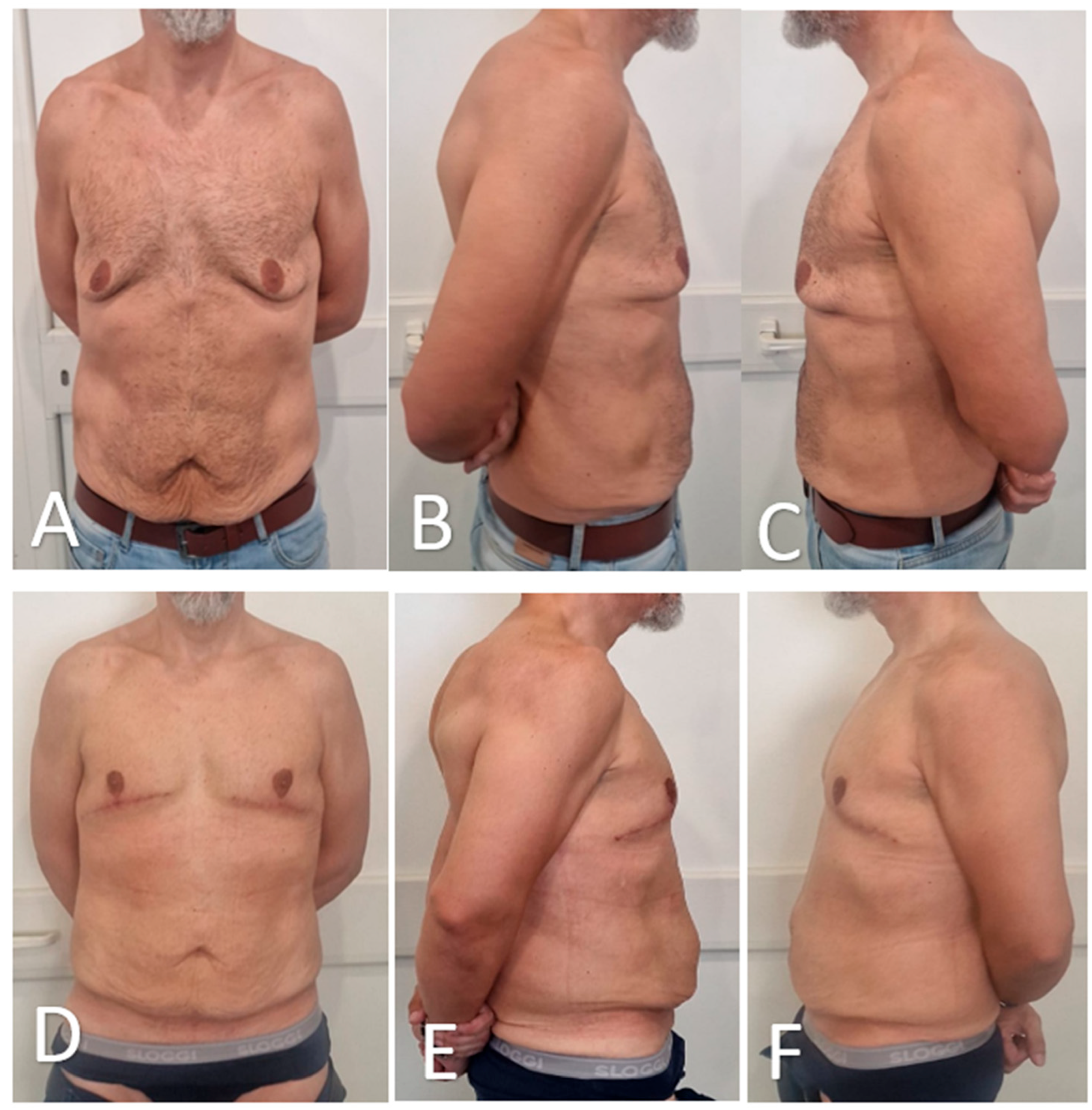 Medicina 61 01842 g008