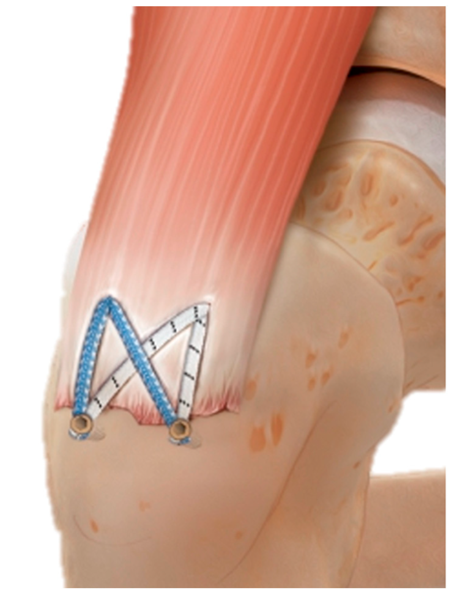 Medicina 61 01863 g002