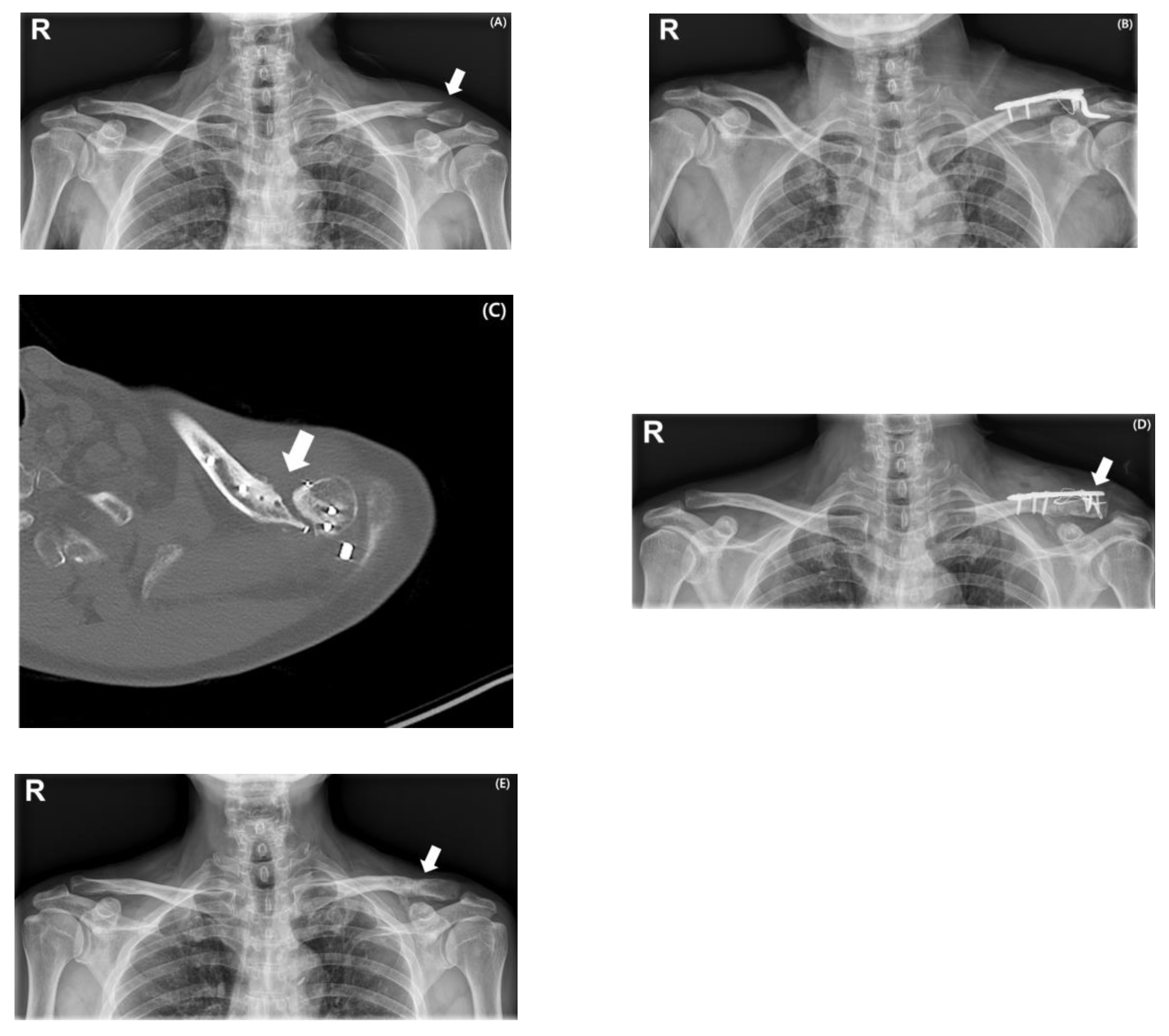 Medicina 61 01882 g003 Medicina 61 01882 g003