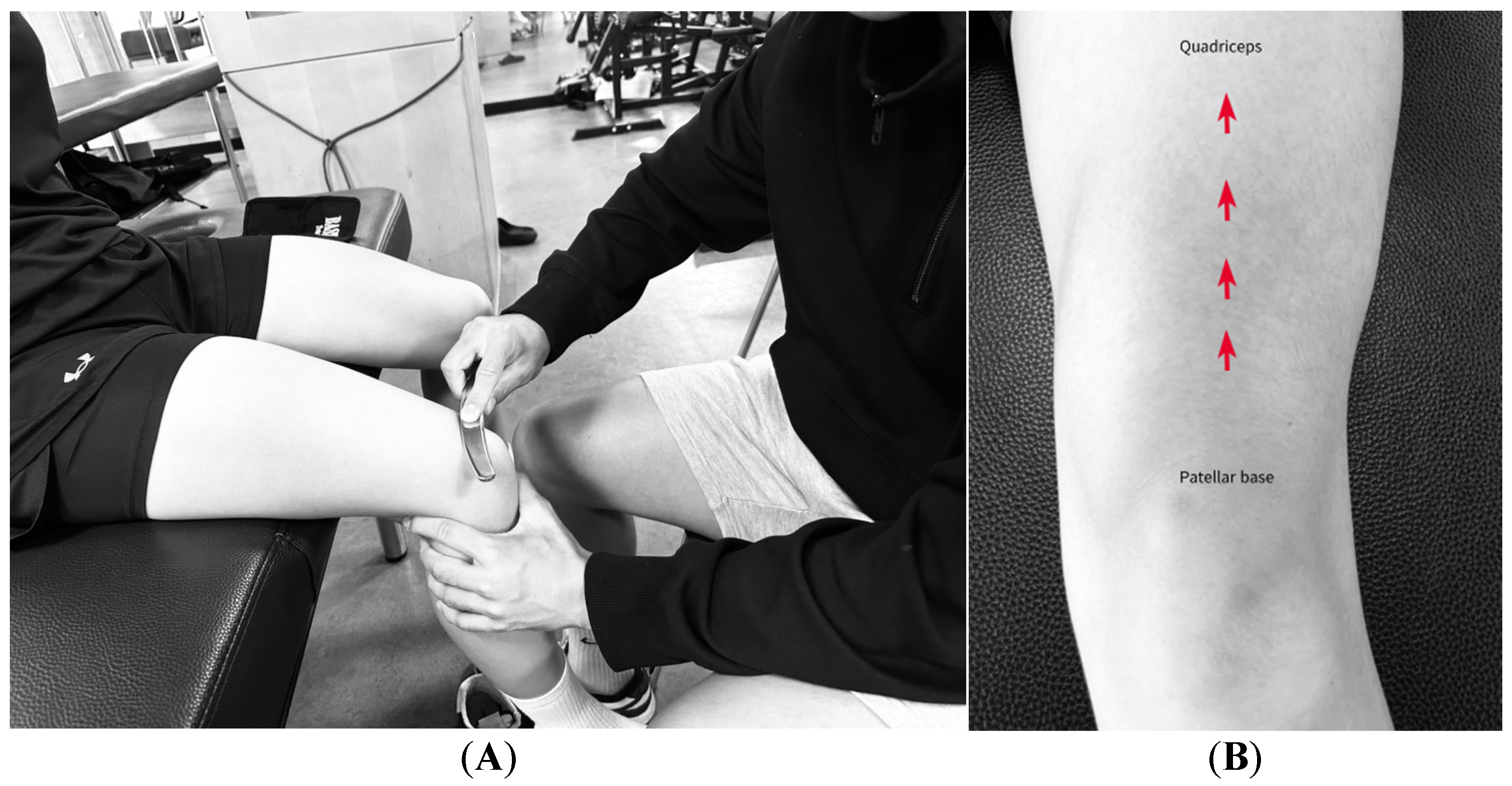 Medicina 61 01912 g007 Medicina 61 01912 g007