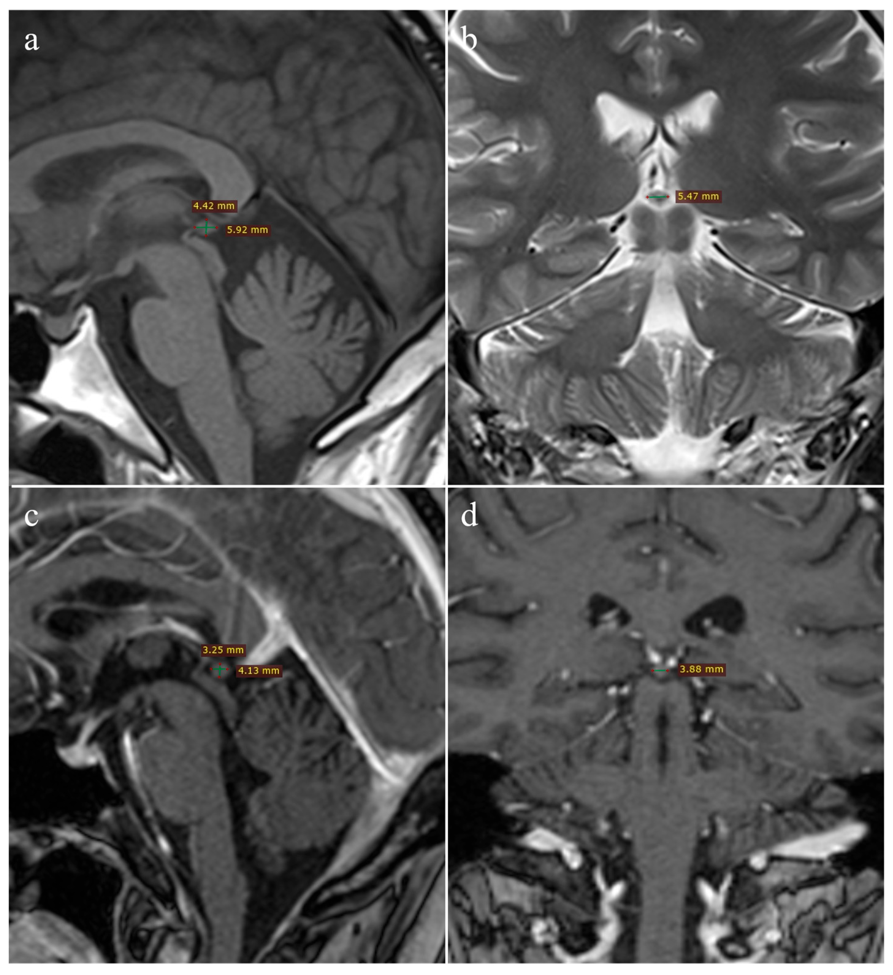 Medicina 61 01923 g001