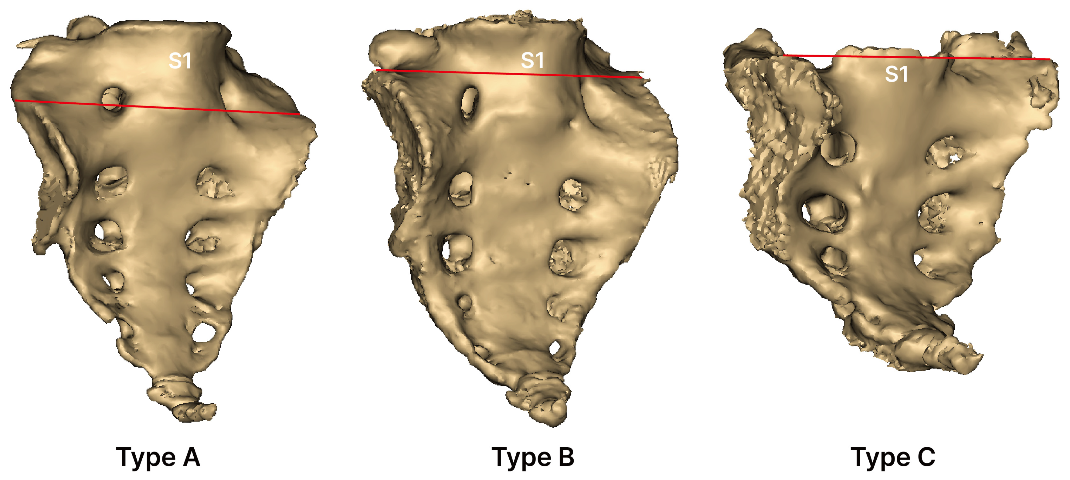 Medicina 61 01942 g004