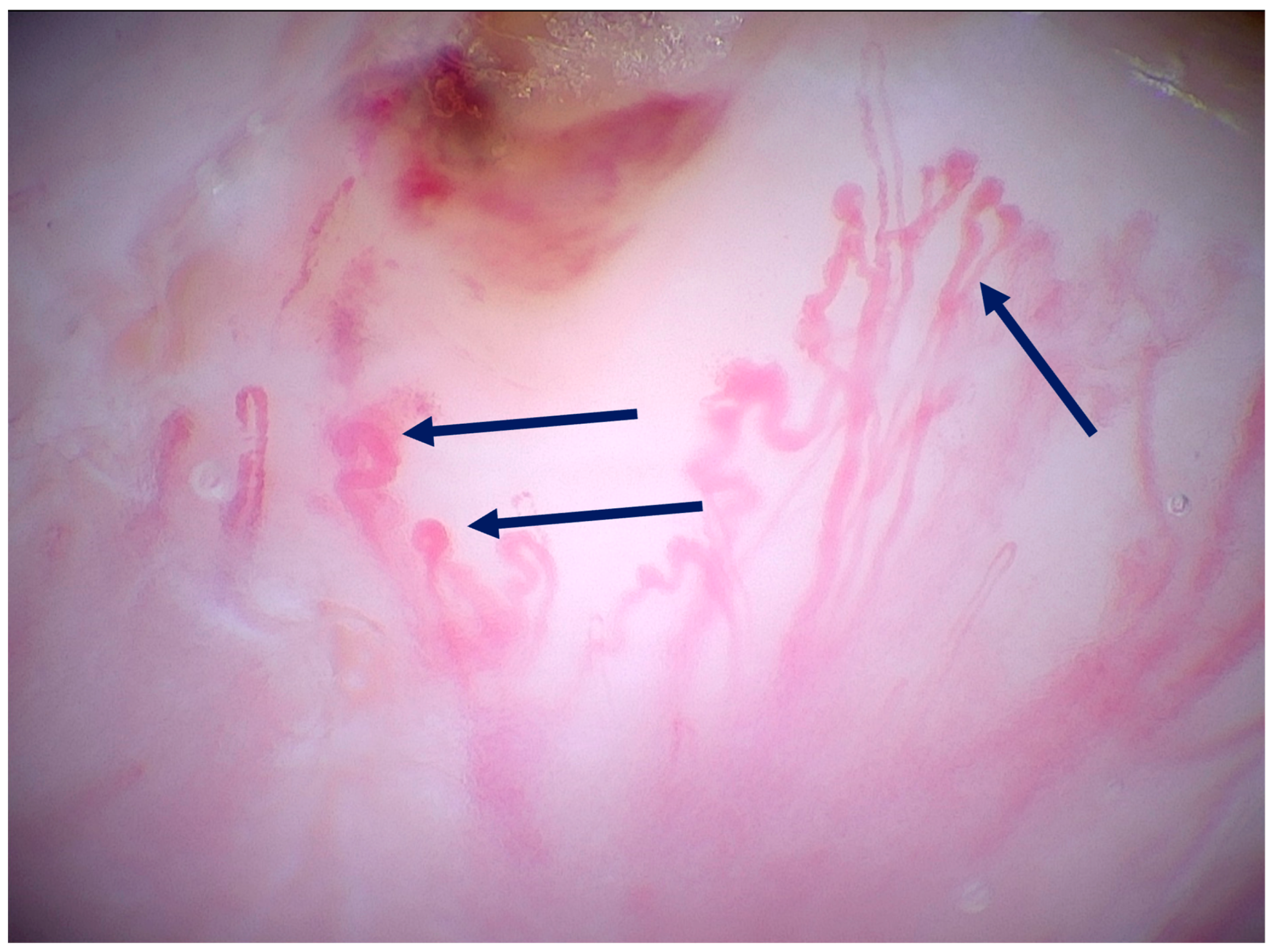 Medicina 61 01970 g004