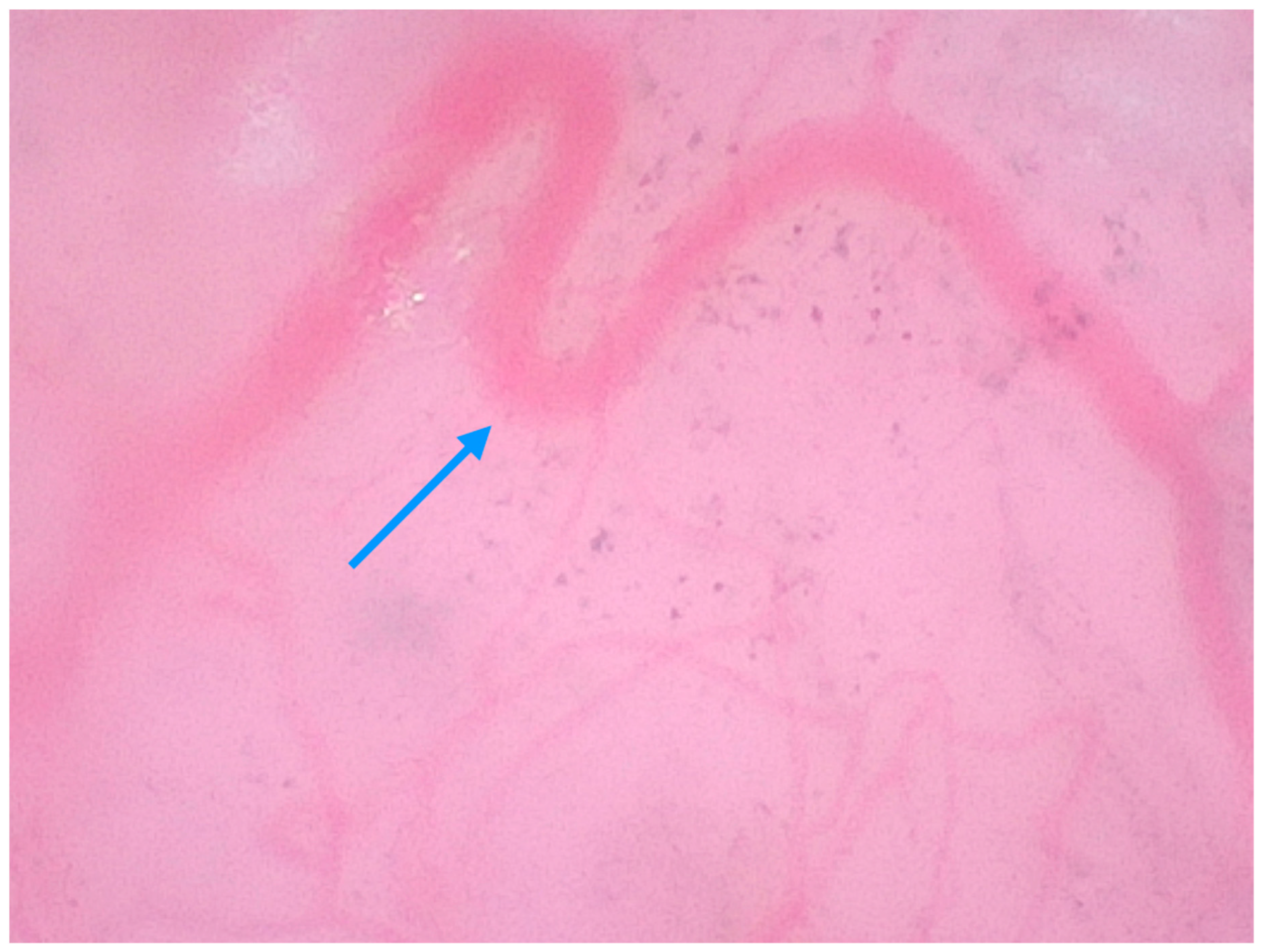 Medicina 61 01970 g005