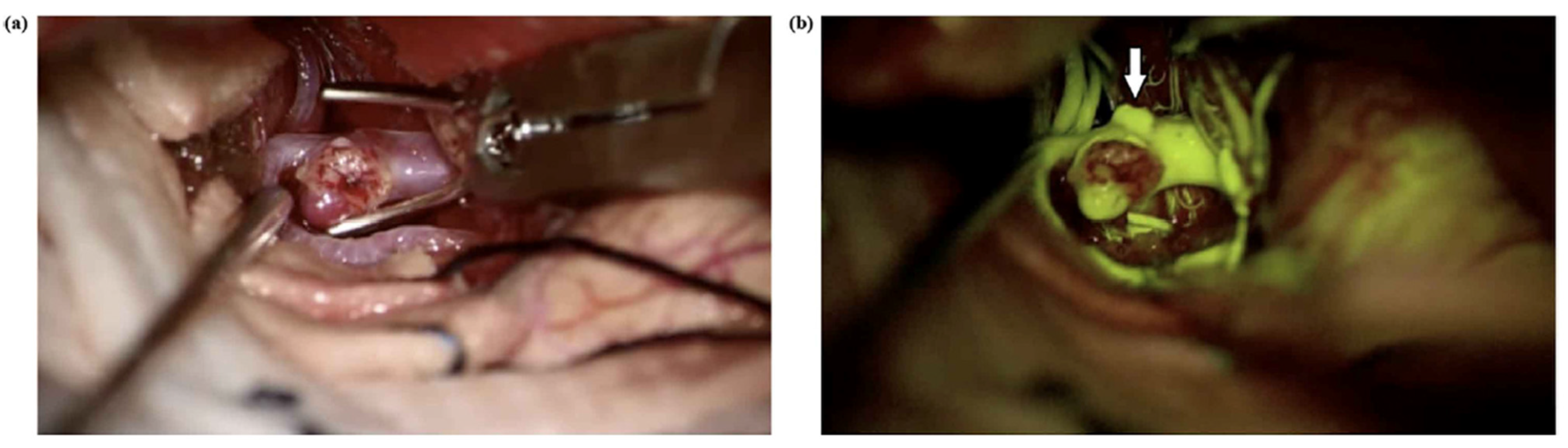 Medicina 61 01974 g008