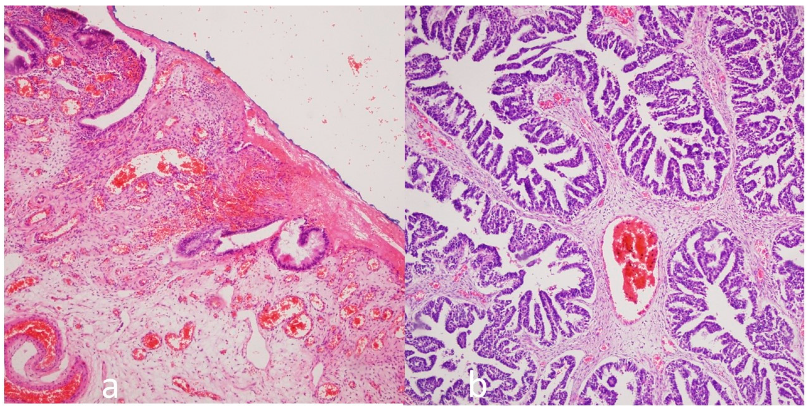 Medicina 61 01983 g002