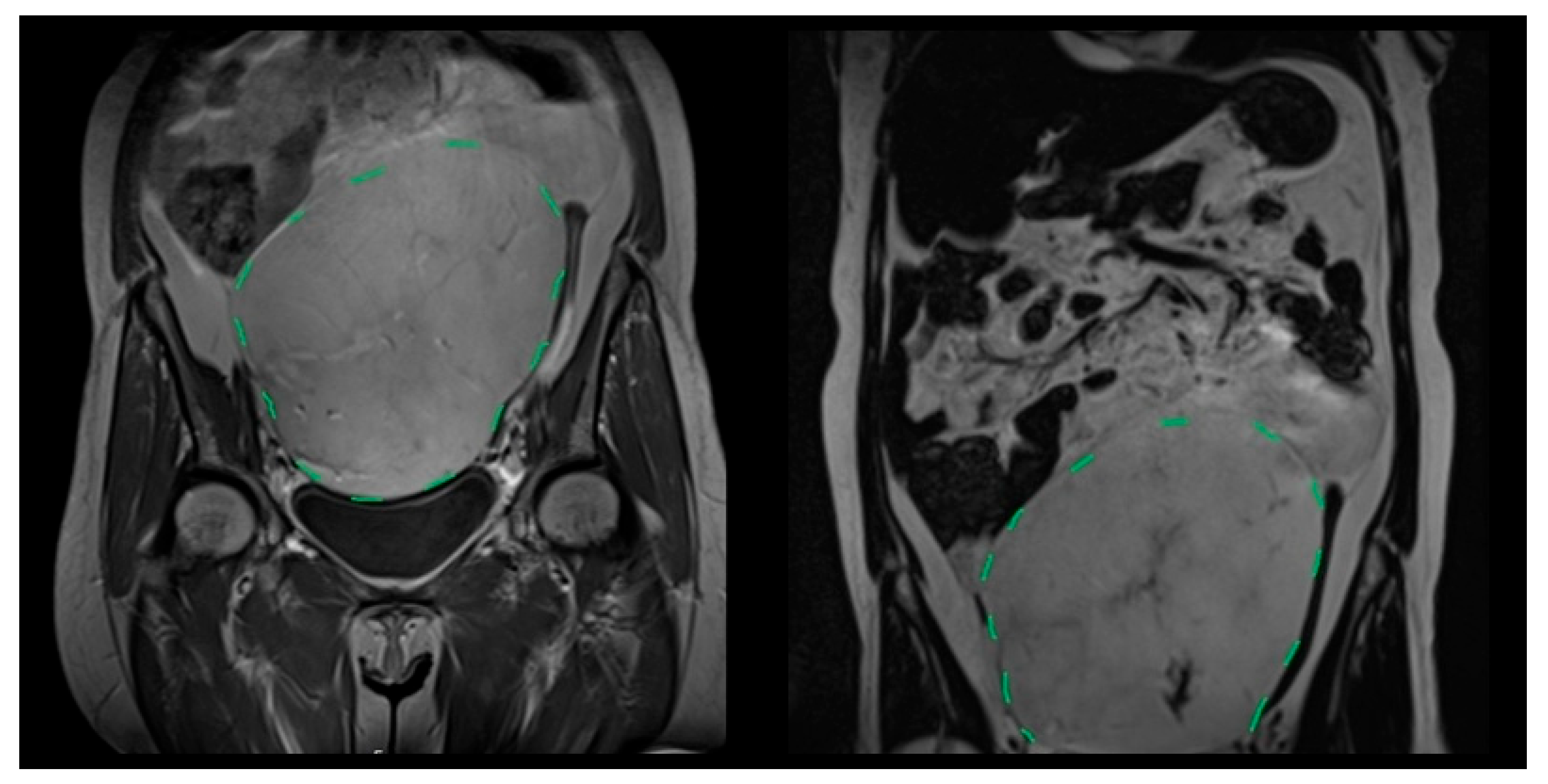 Medicina 61 01984 g001