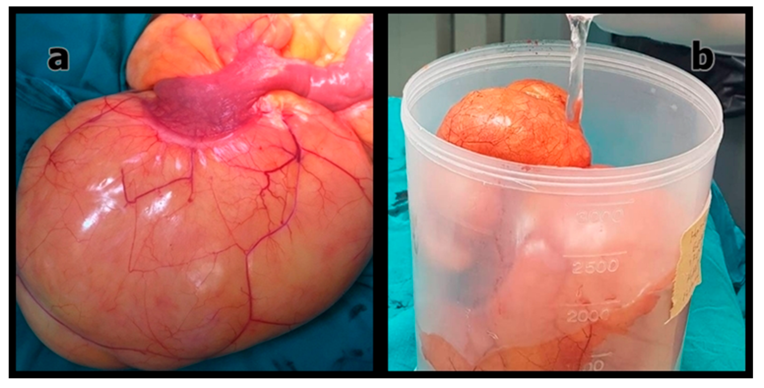 Medicina 61 01984 g002