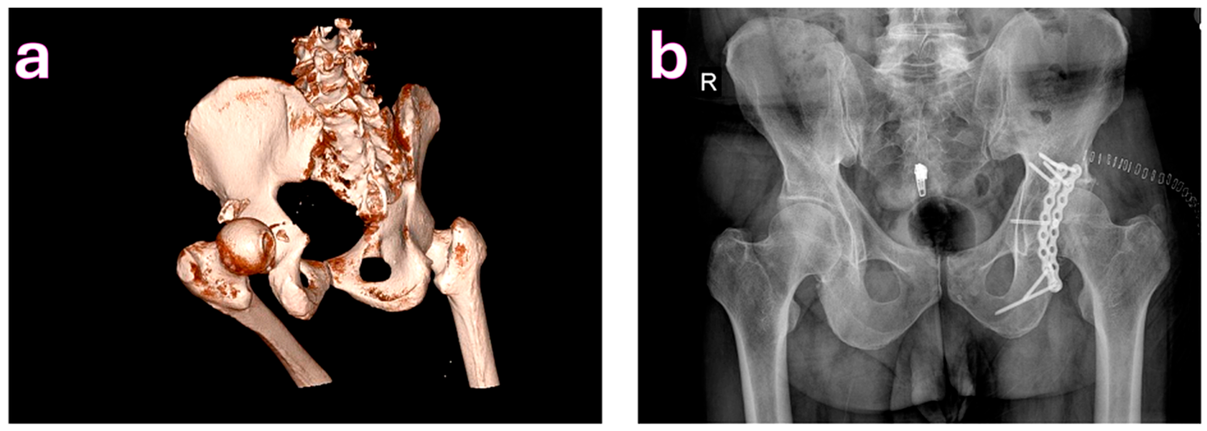 Medicina 61 01995 g002