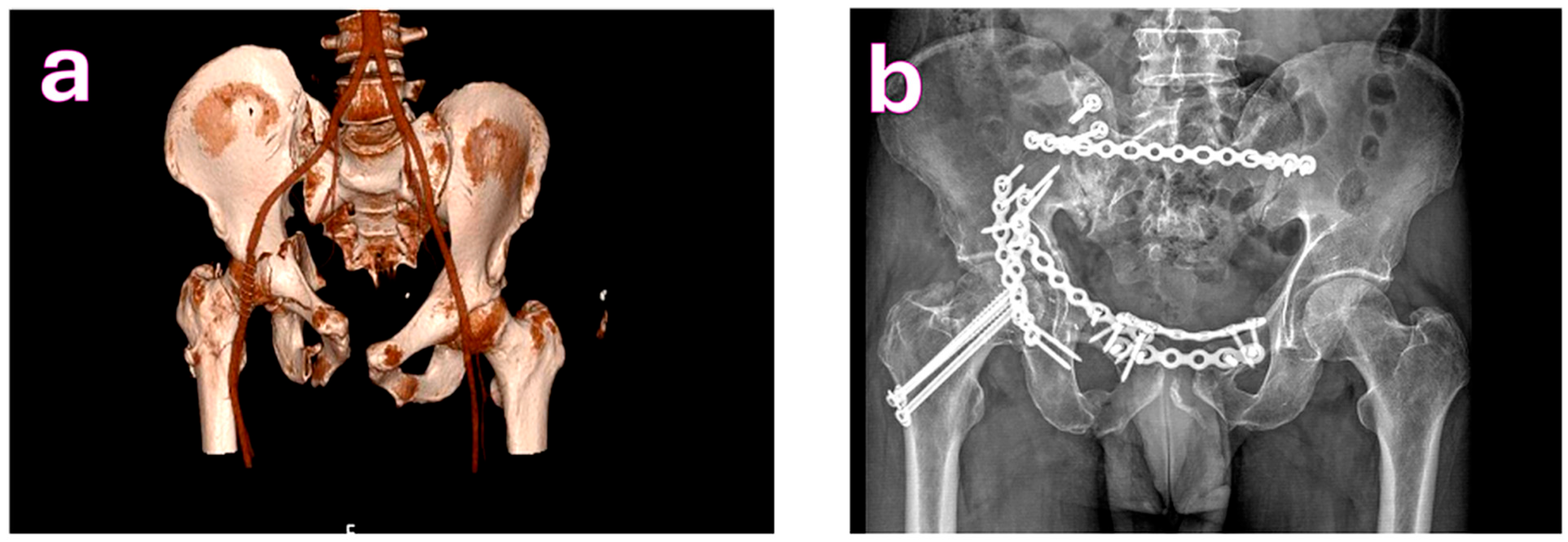 Medicina 61 01995 g003