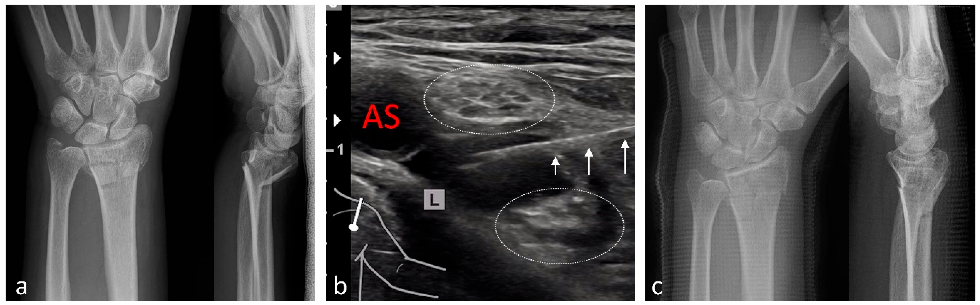 Medicina 61 02006 g004