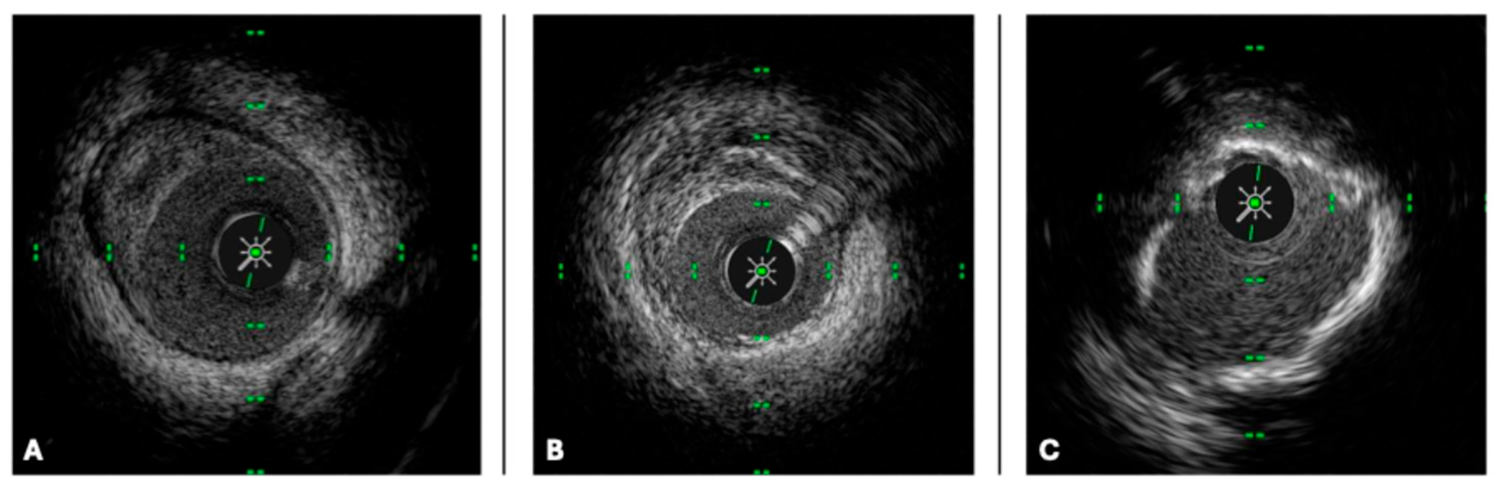 Medicina 61 02019 g002