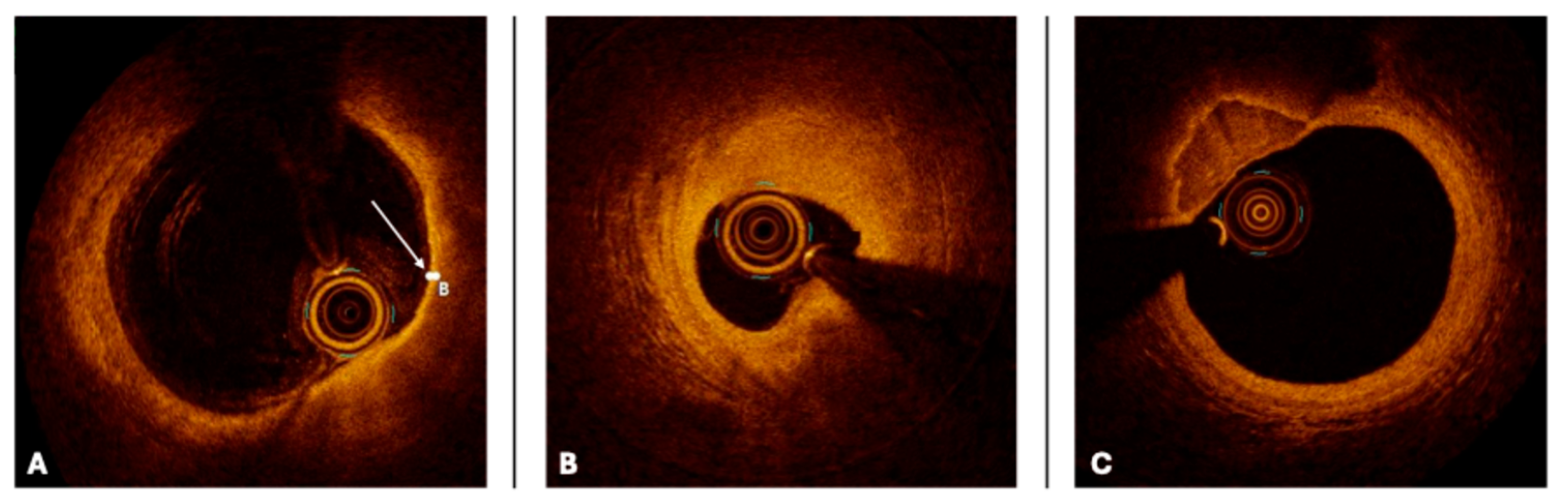 Medicina 61 02019 g003