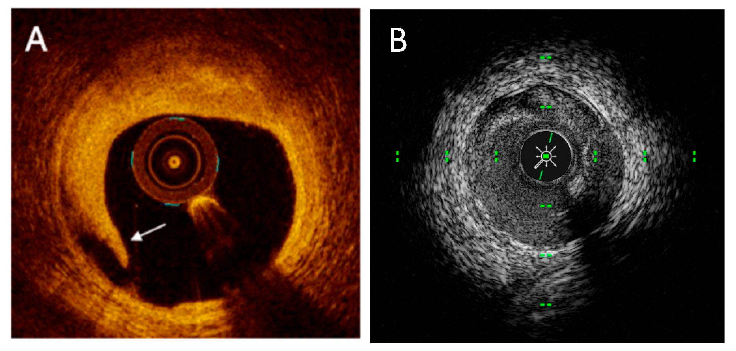 Medicina 61 02019 g006