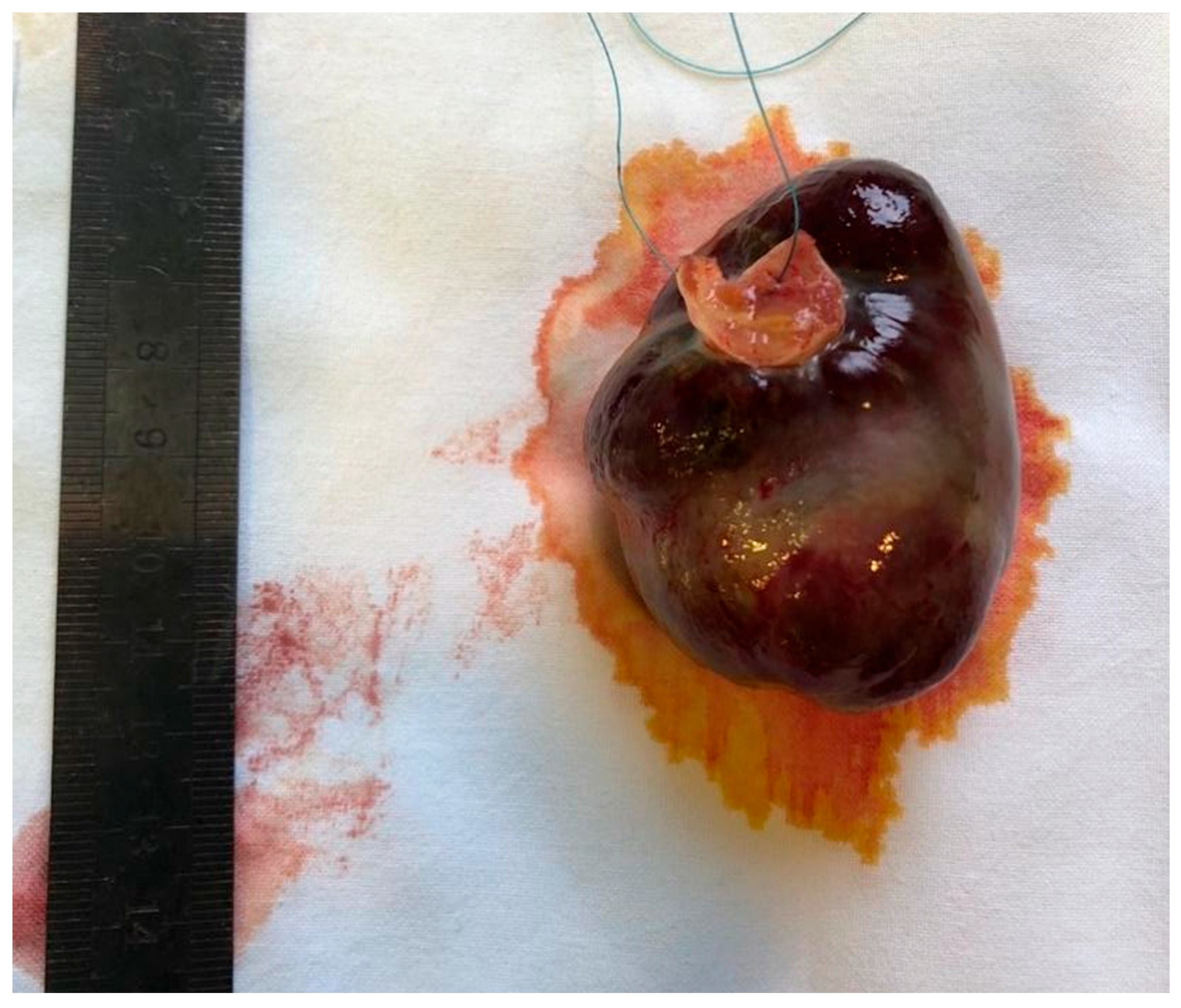 Medicina 61 02025 g001