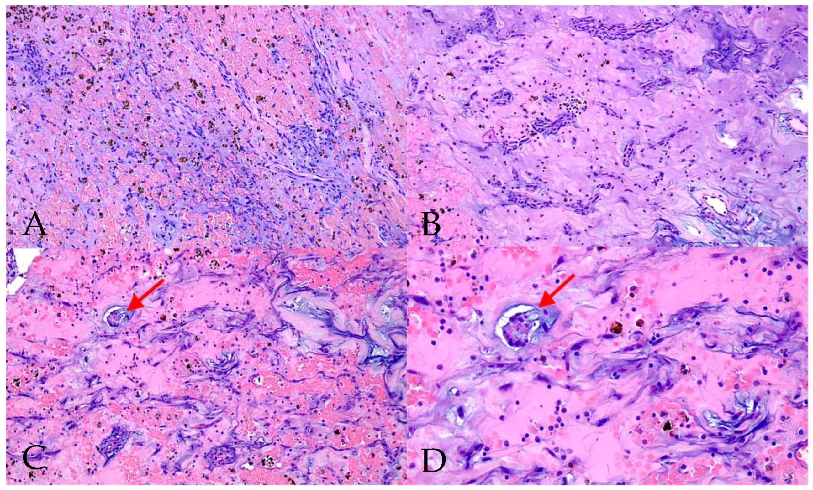 Medicina 61 02025 g002