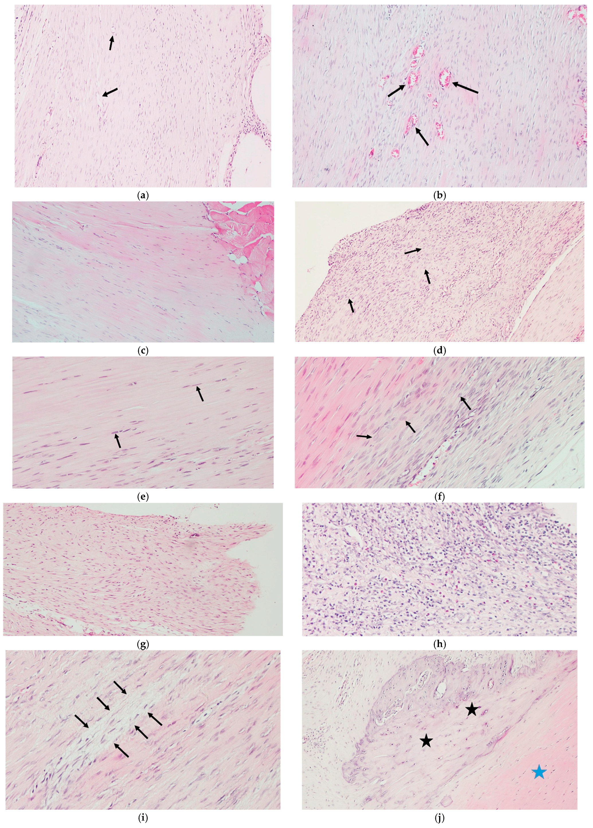 Medicina 61 02035 g004