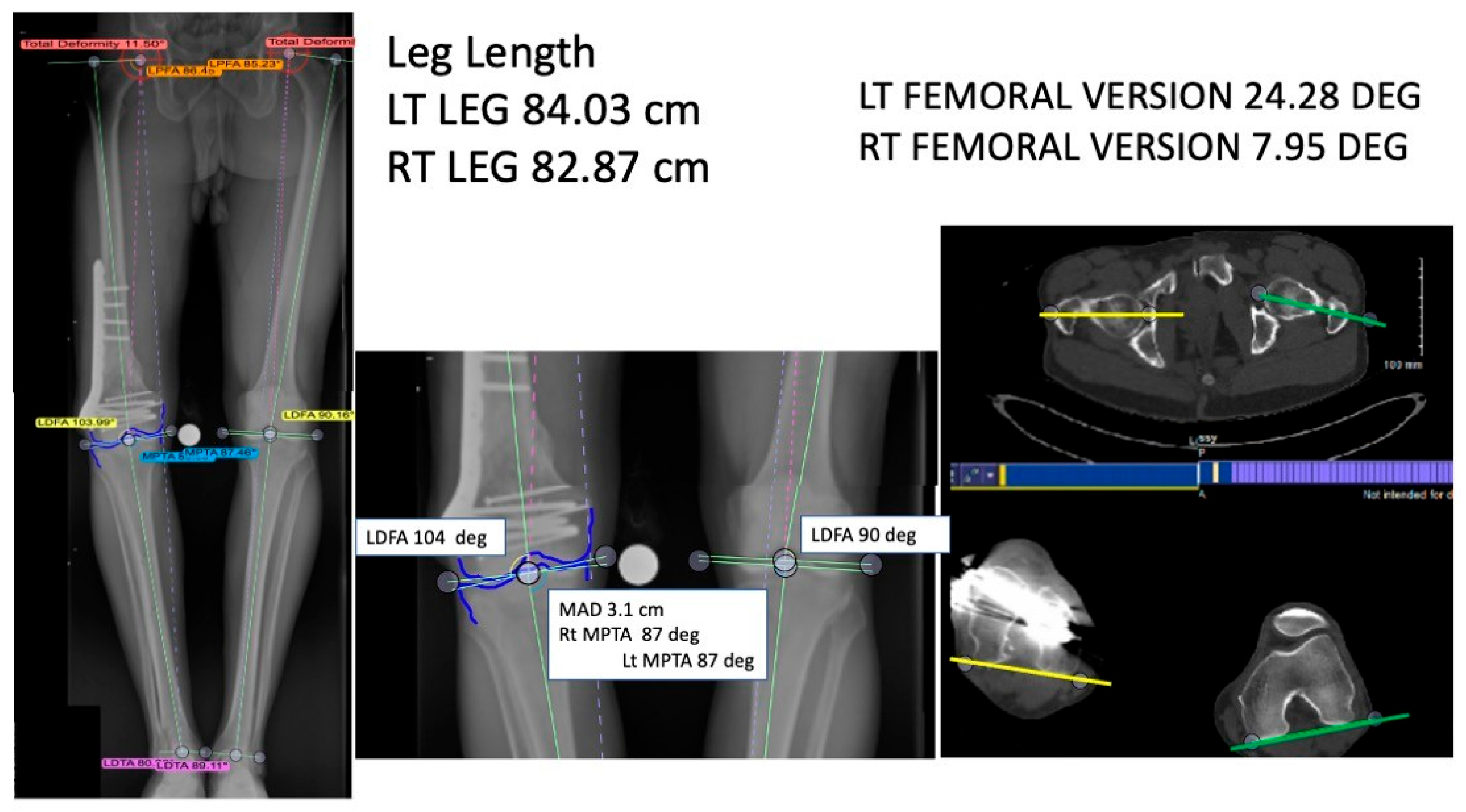 Medicina 61 02050 g002 Medicina 61 02050 g002