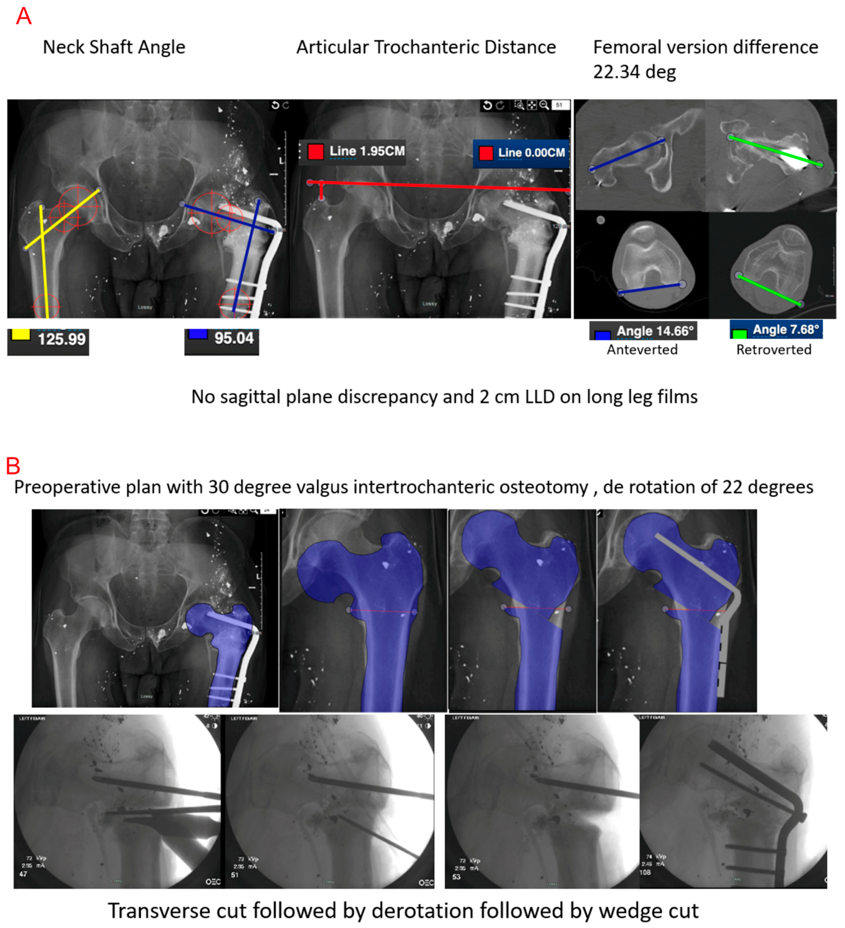 Medicina 61 02050 g003a Medicina 61 02050 g003a