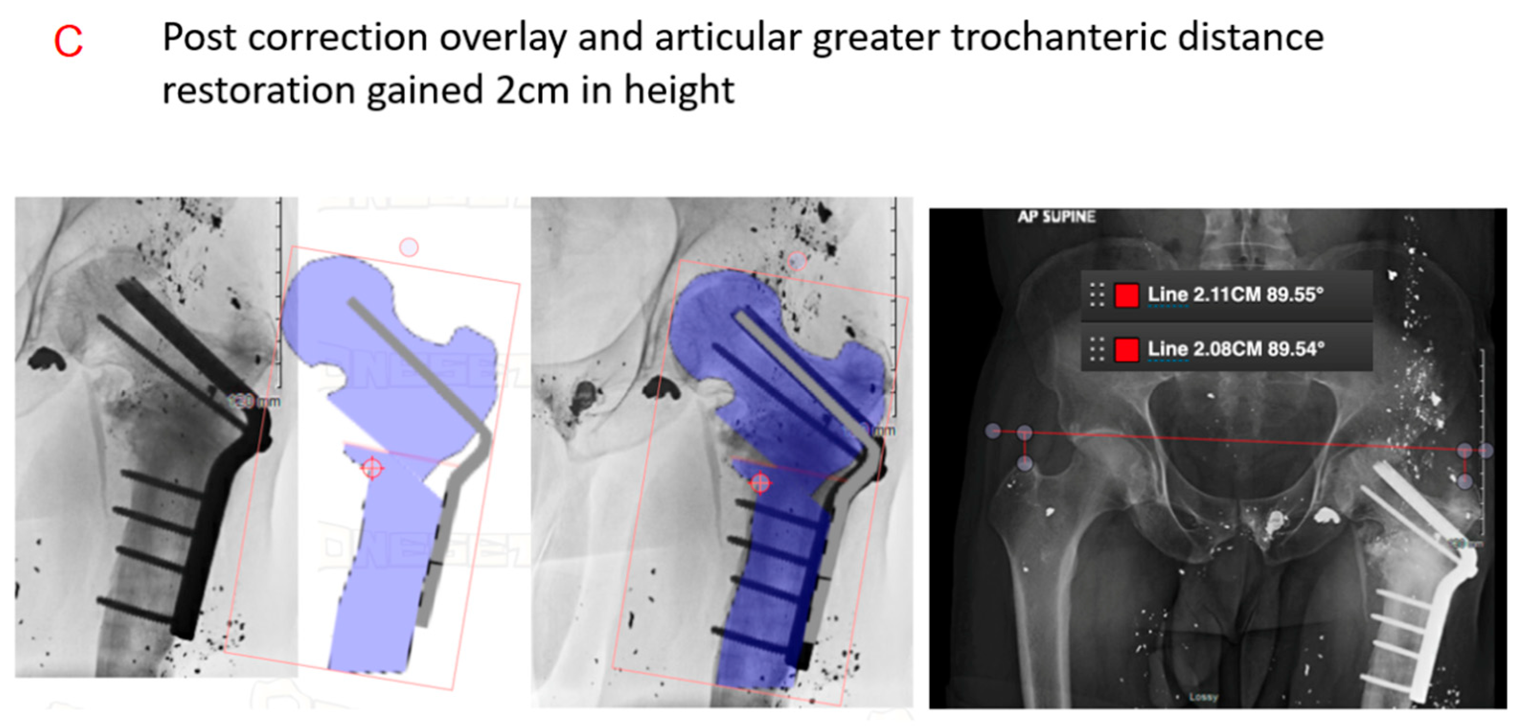 Medicina 61 02050 g003b Medicina 61 02050 g003b