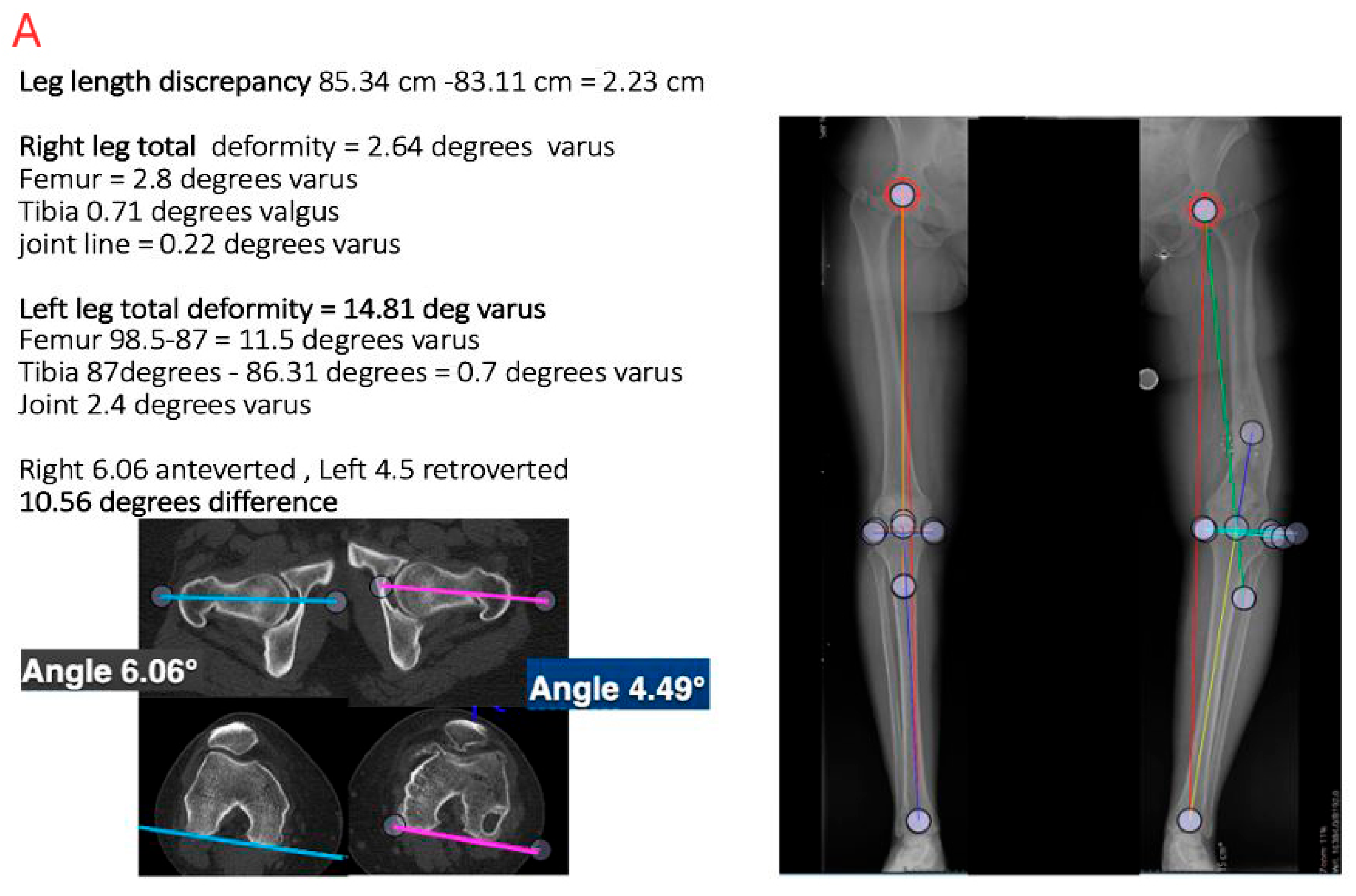 Medicina 61 02050 g004a Medicina 61 02050 g004a