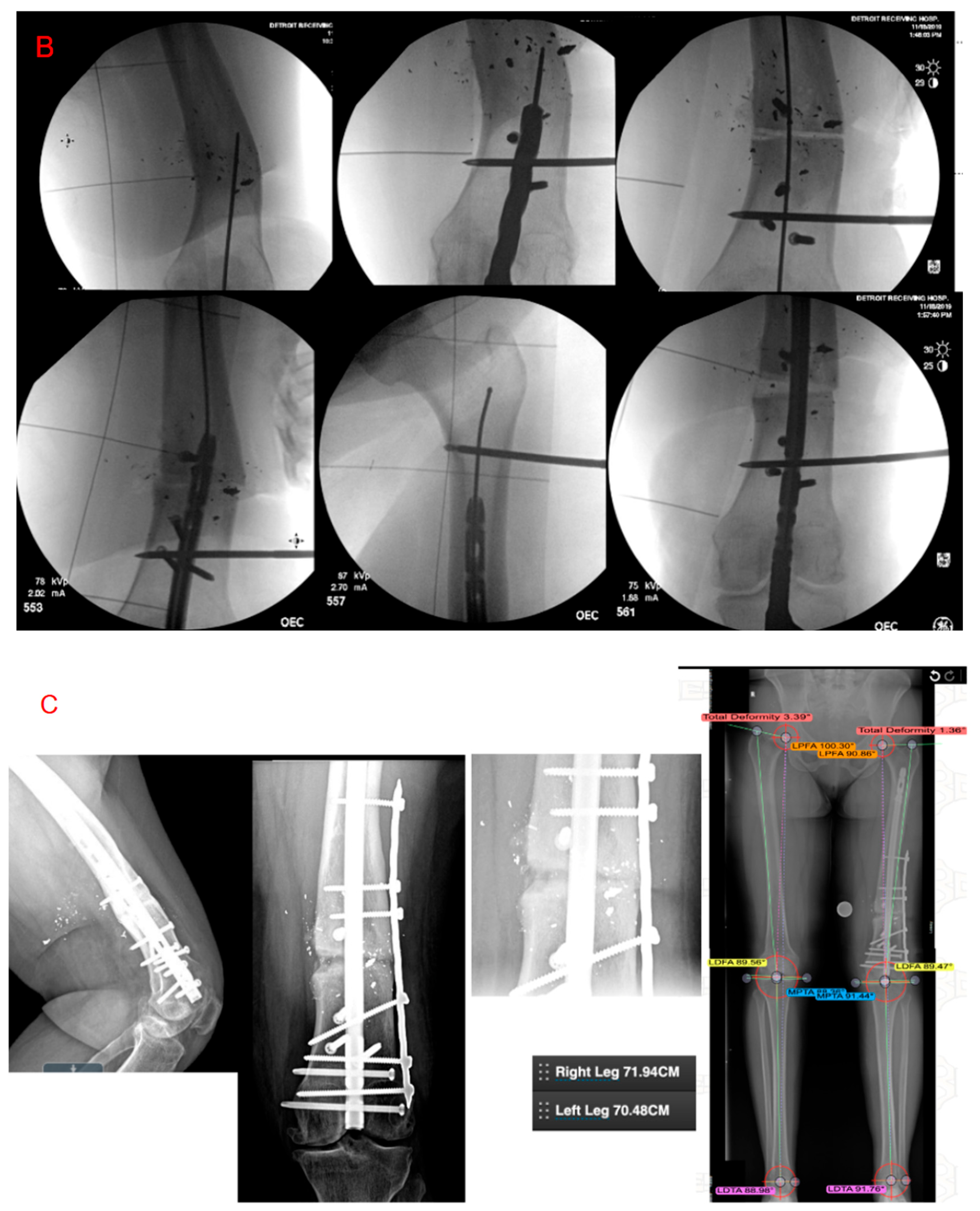 Medicina 61 02050 g004b Medicina 61 02050 g004b