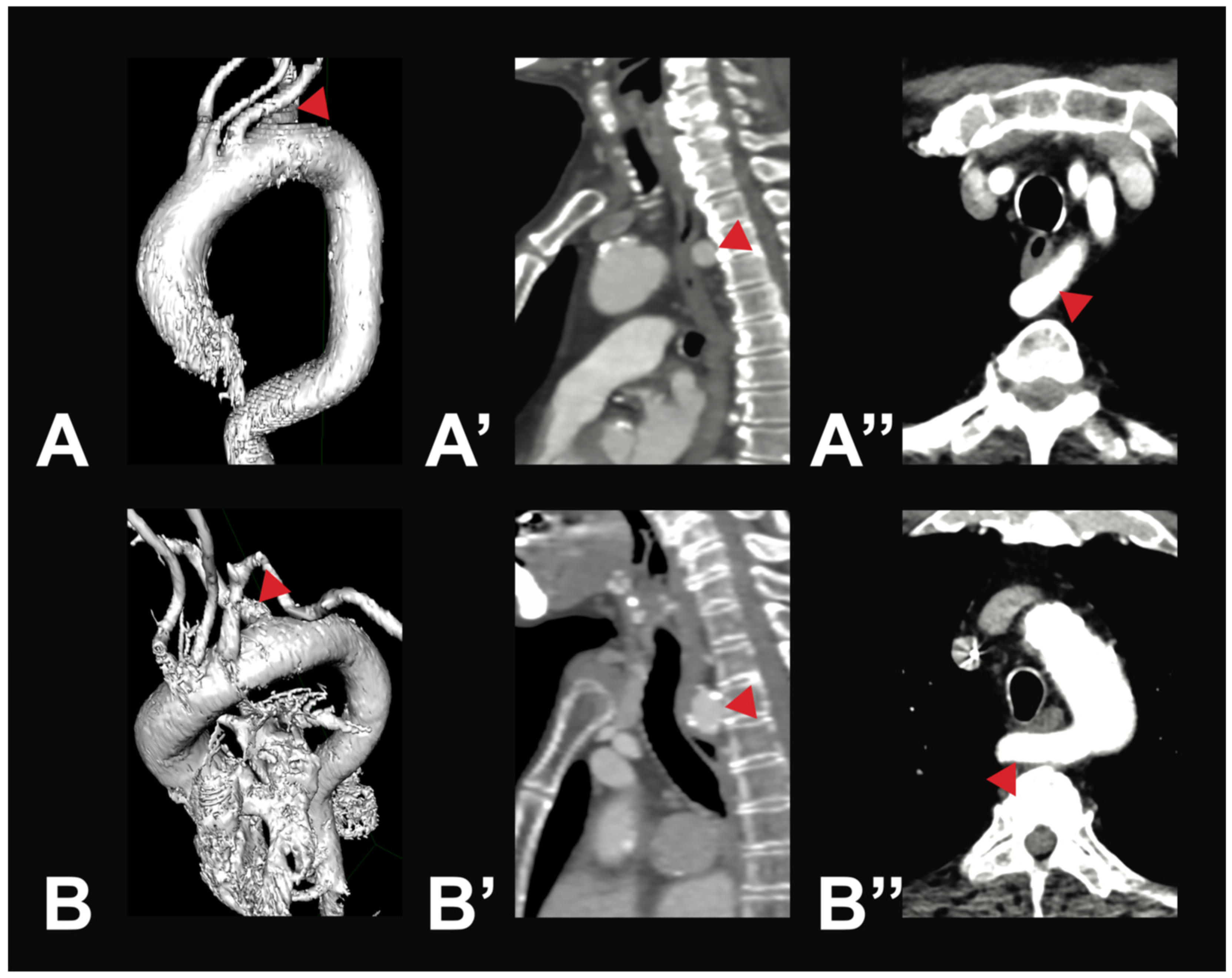 Medicina 61 02059 g003 Medicina 61 02059 g003