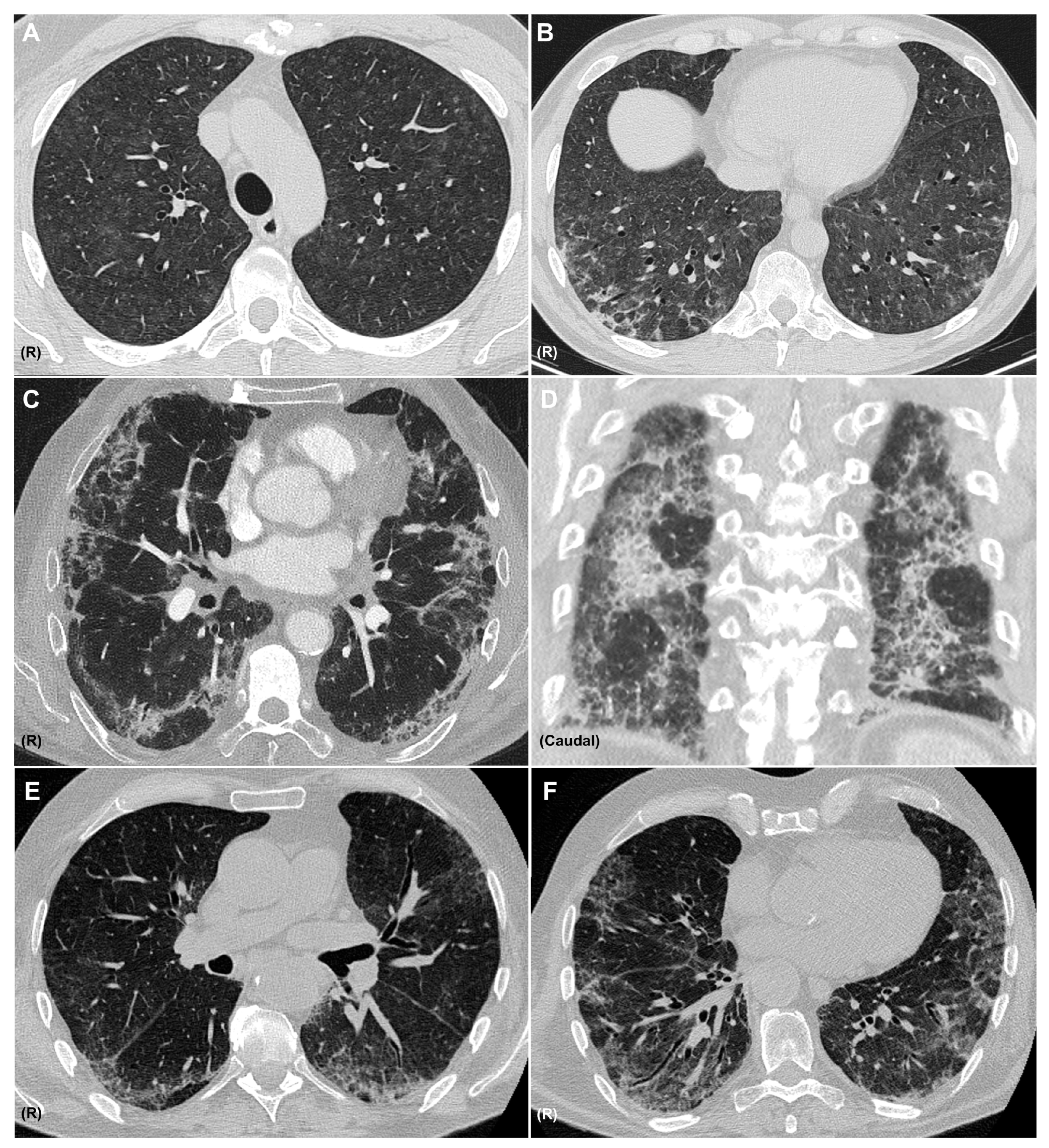 Medicina 61 02064 g003