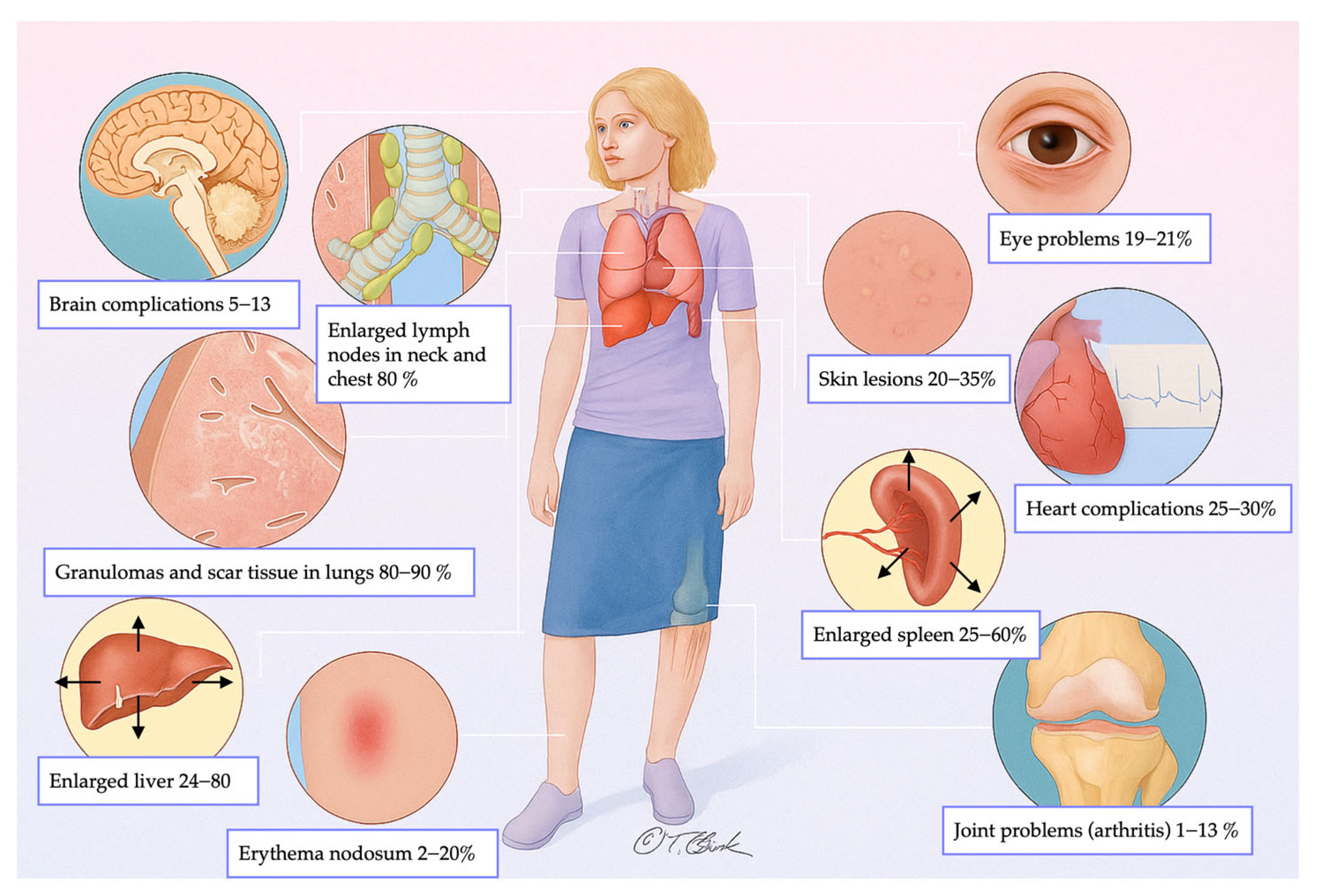Medicina 61 02094 g001 Medicina 61 02094 g001