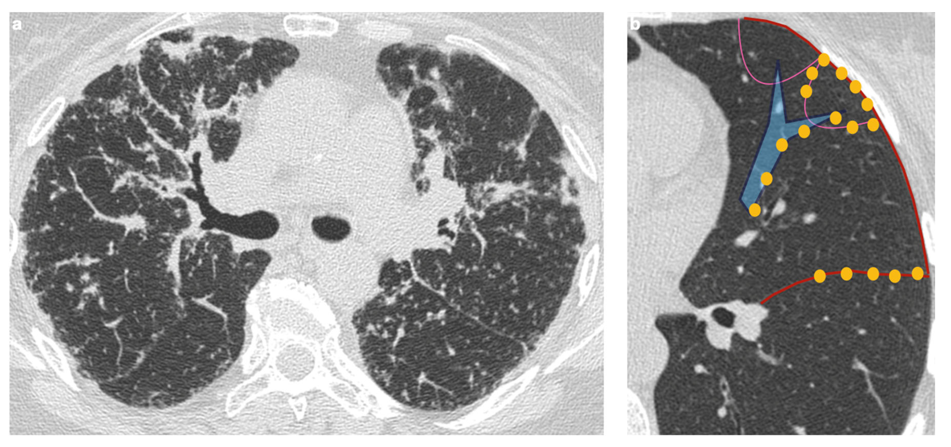 Medicina 61 02094 g003 Medicina 61 02094 g003