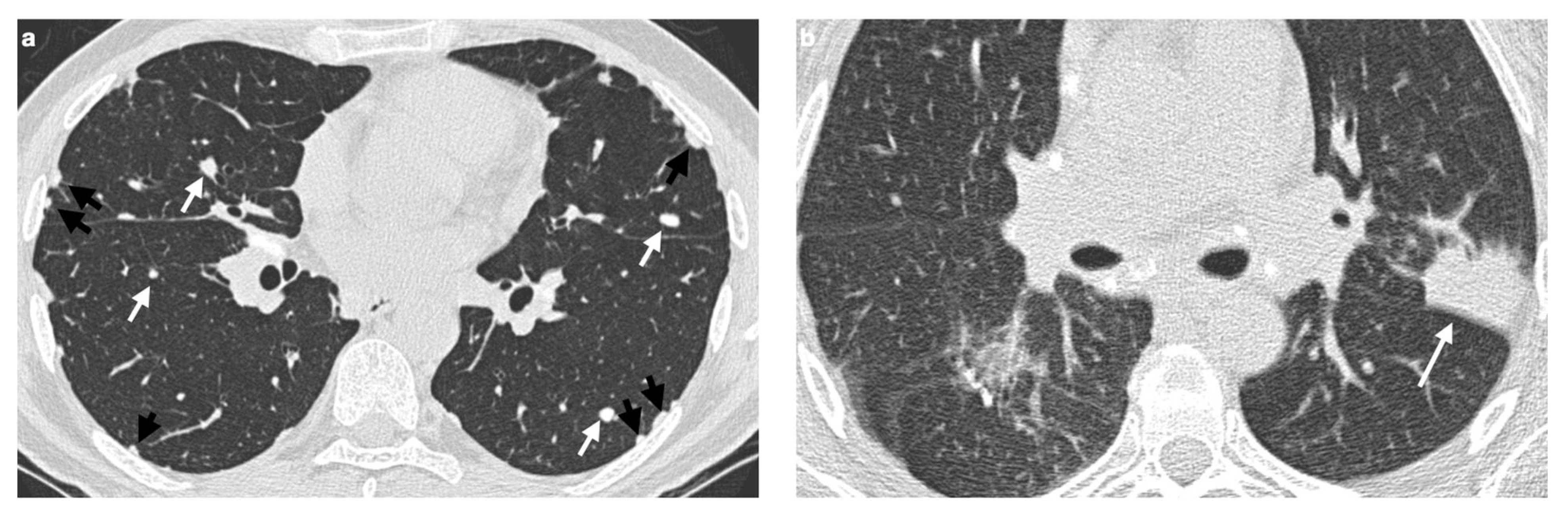 Medicina 61 02094 g004 Medicina 61 02094 g004