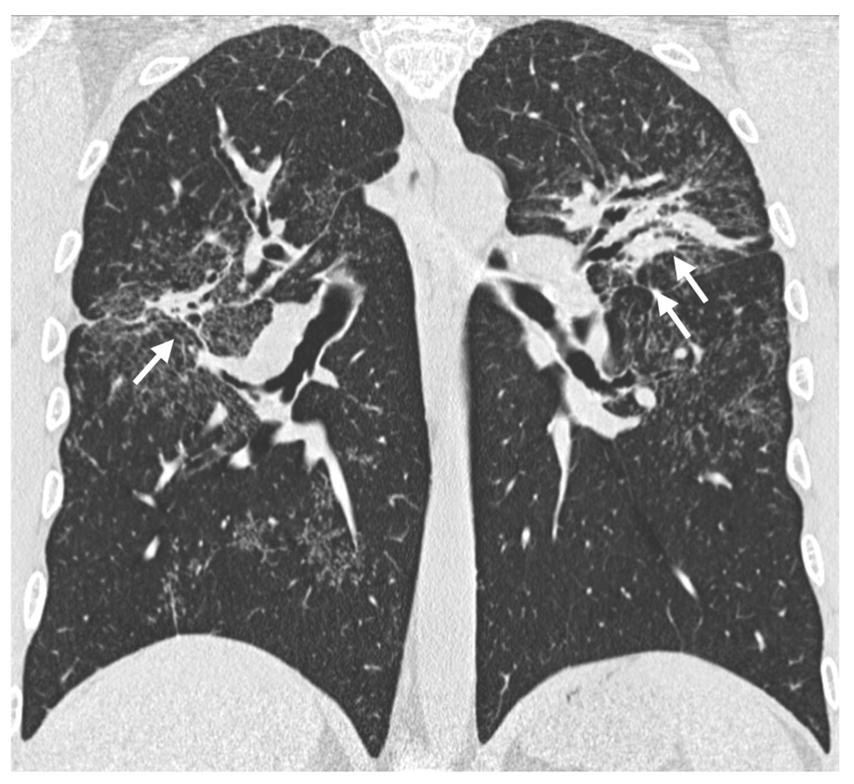 Medicina 61 02094 g005 Medicina 61 02094 g005