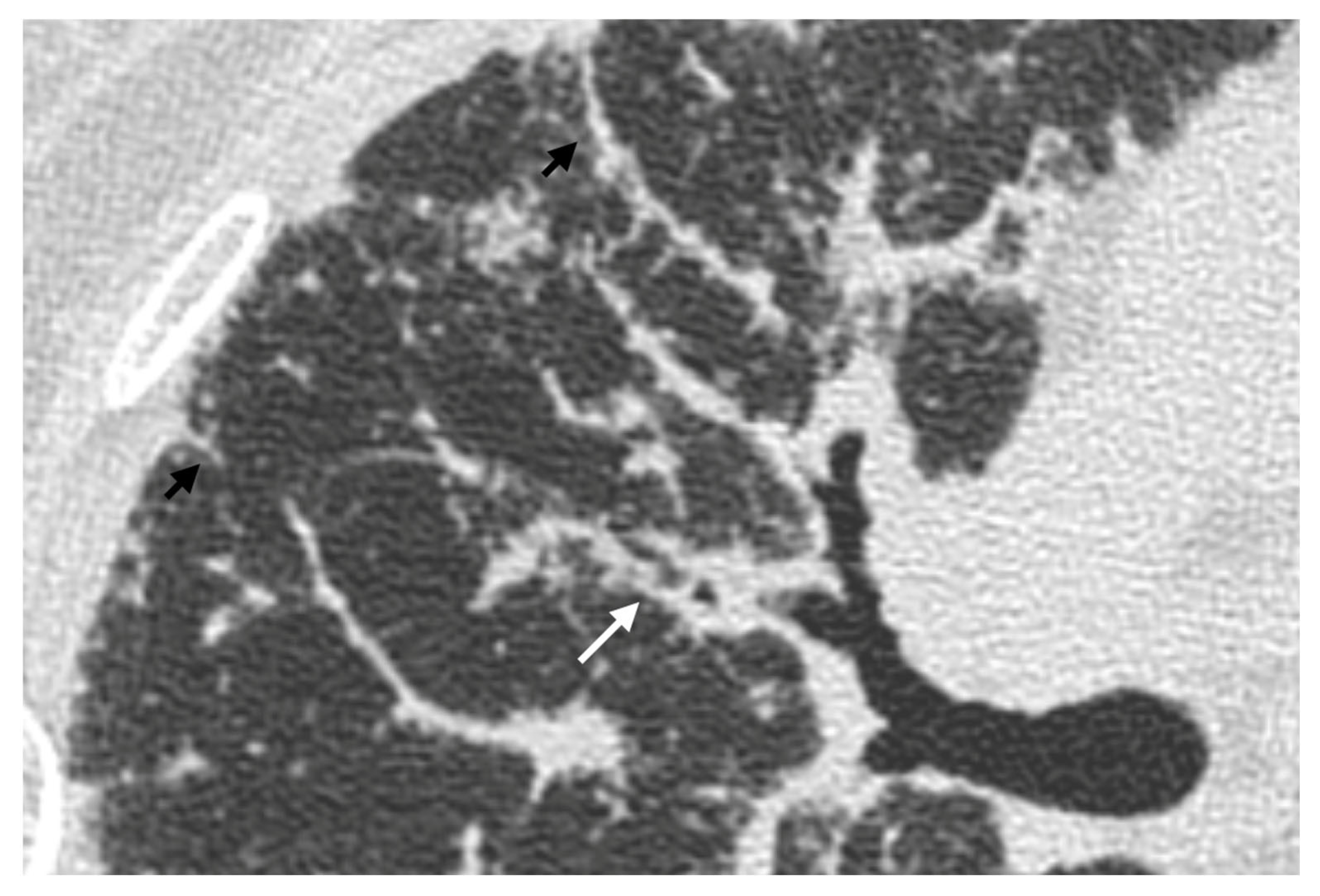 Medicina 61 02094 g006 Medicina 61 02094 g006