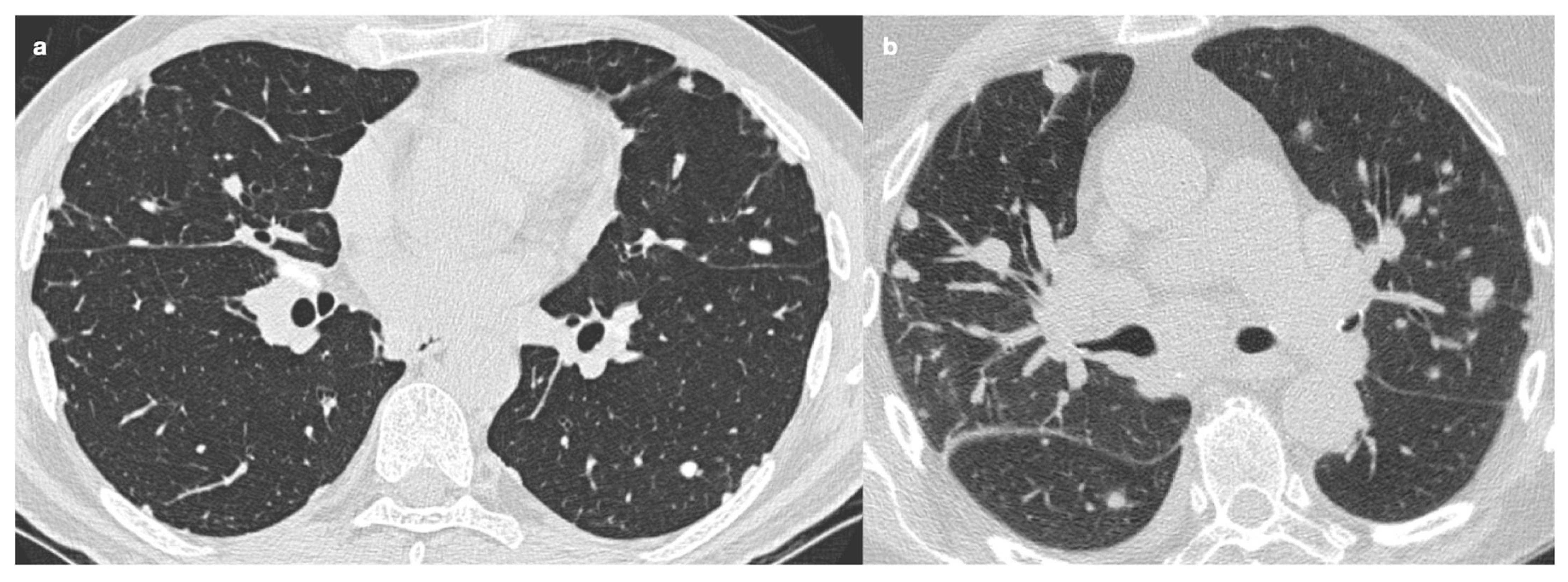 Medicina 61 02094 g007 Medicina 61 02094 g007