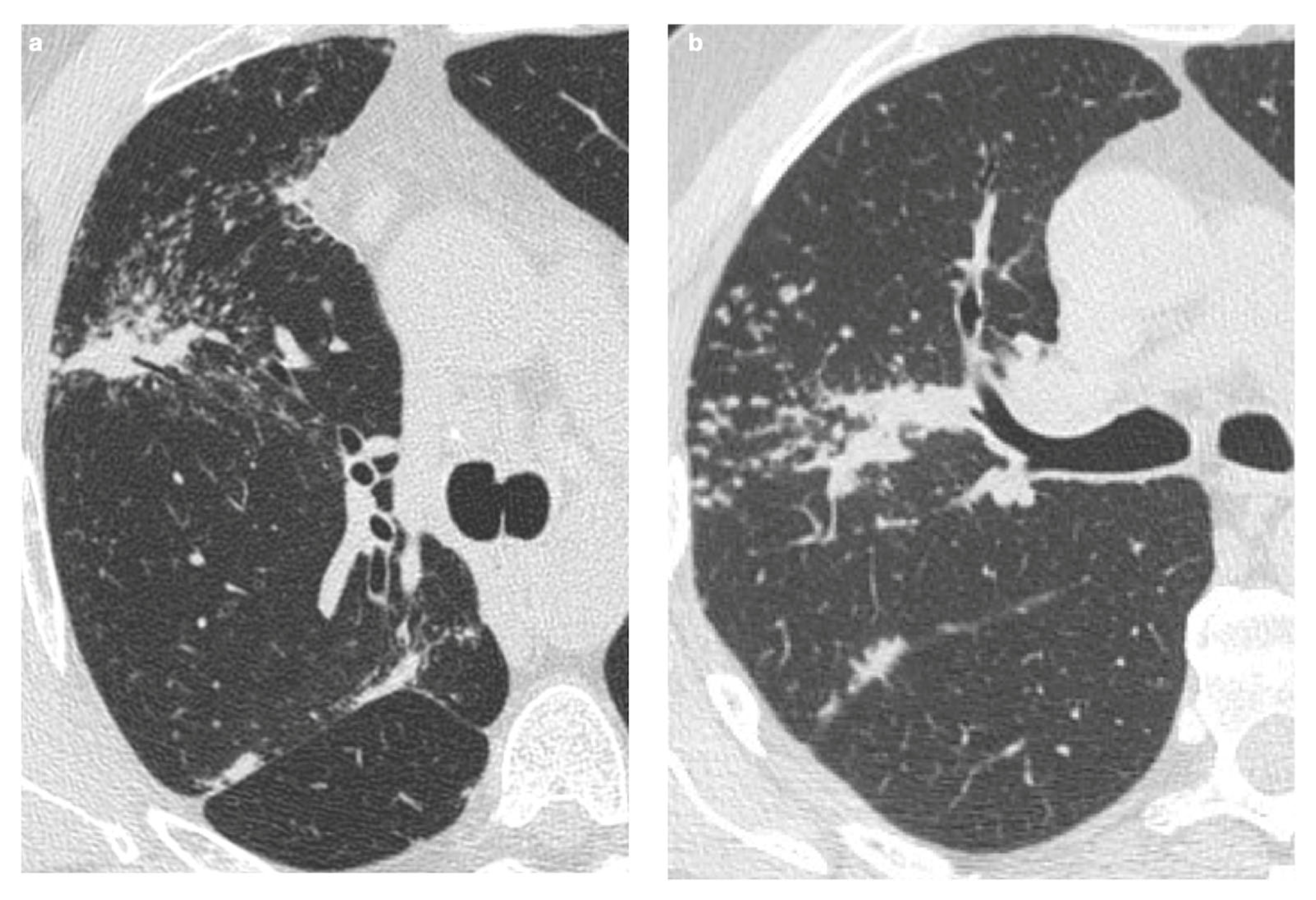 Medicina 61 02094 g008 Medicina 61 02094 g008