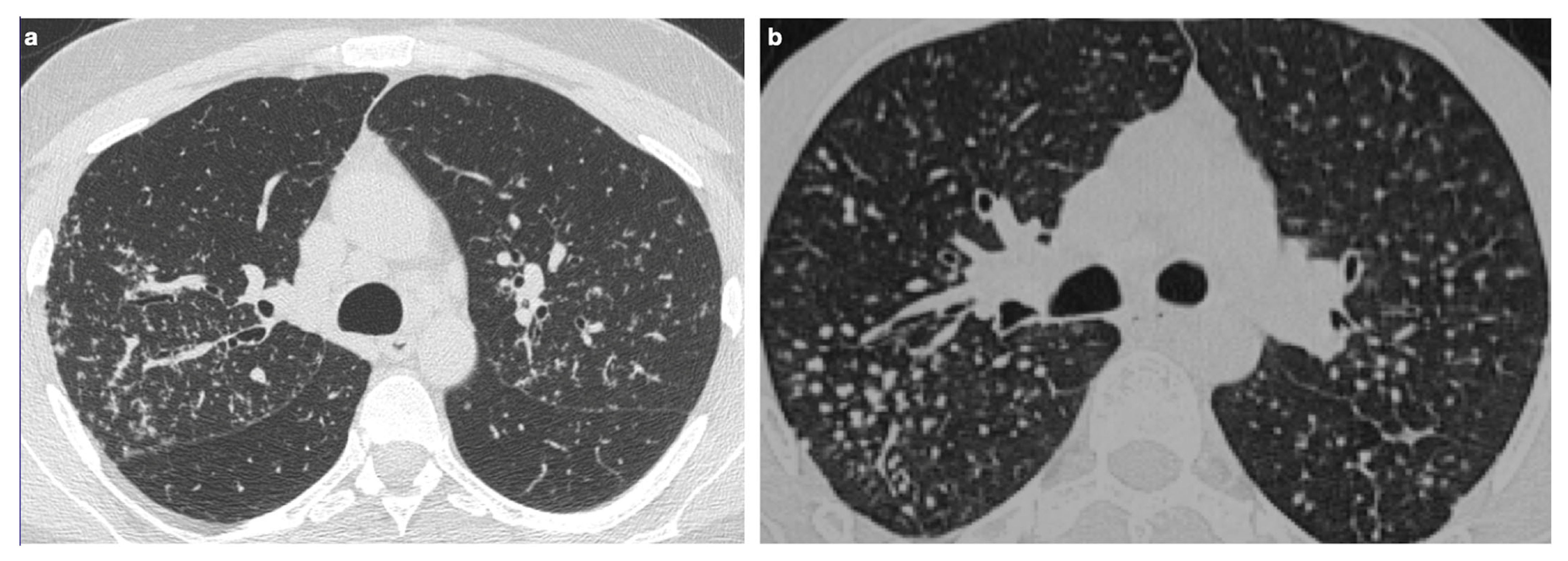 Medicina 61 02094 g009 Medicina 61 02094 g009