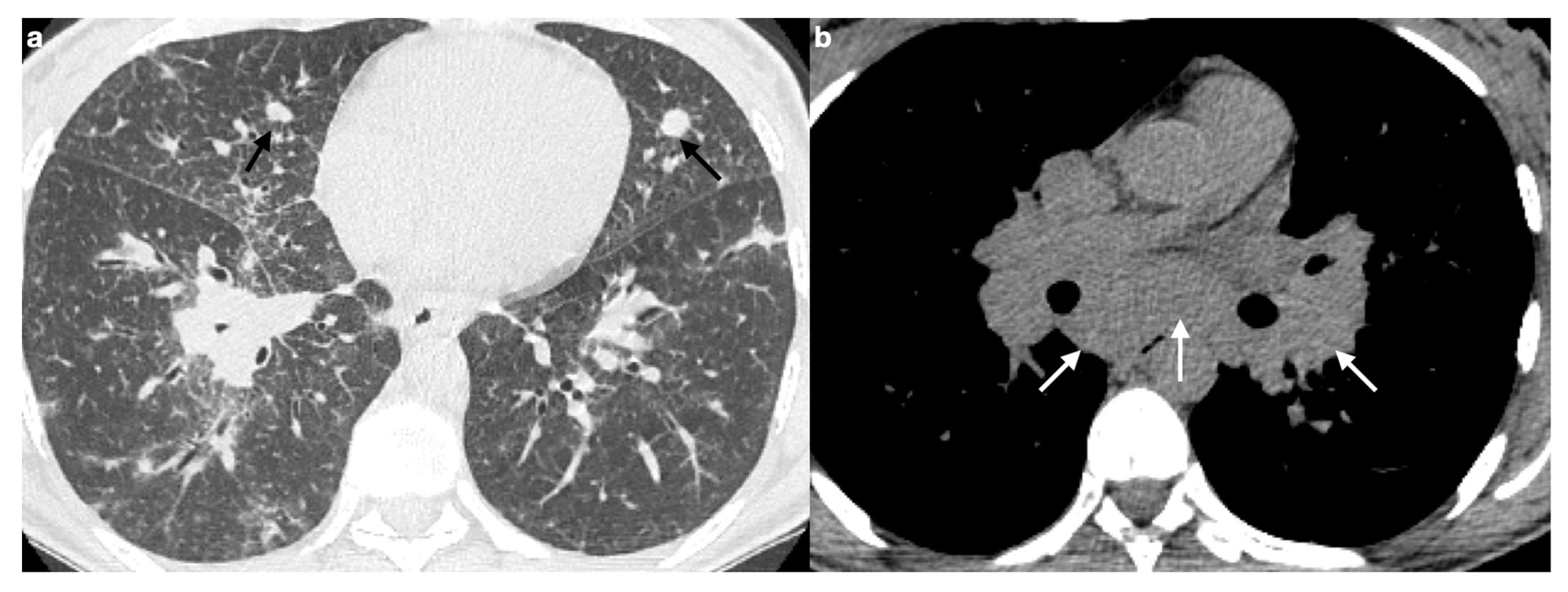 Medicina 61 02094 g010 Medicina 61 02094 g010