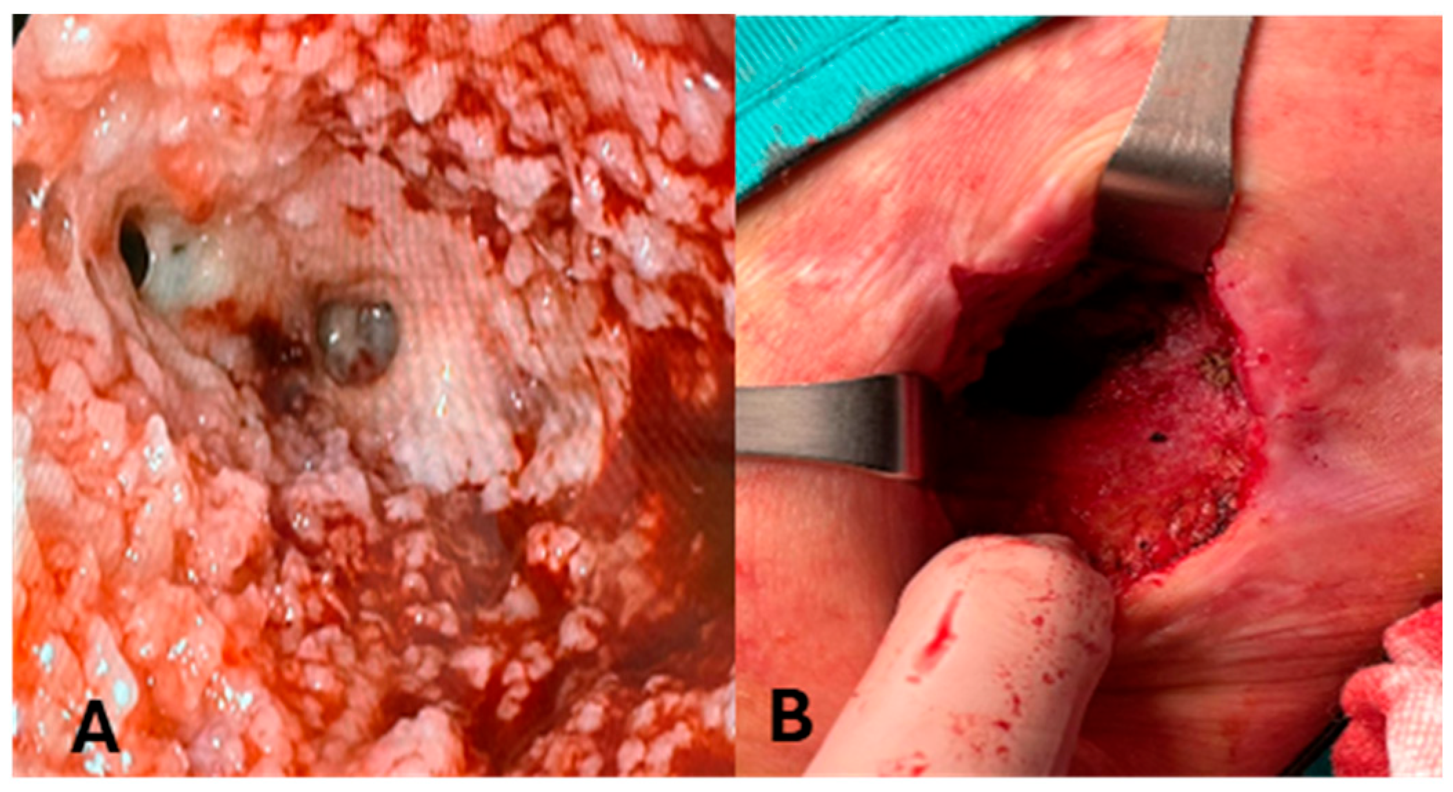 Medicina 61 02102 g002 Medicina 61 02102 g002