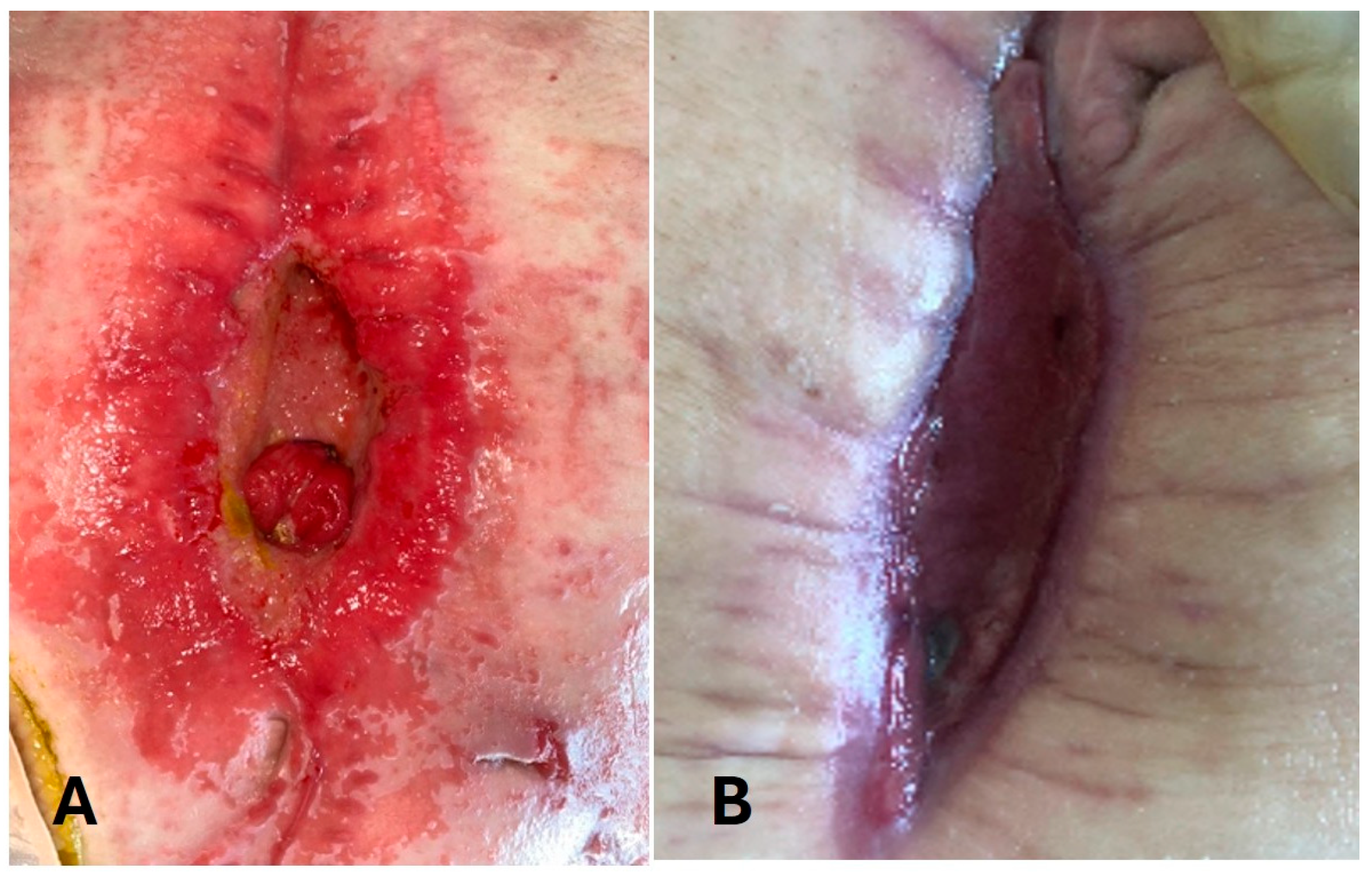 Medicina 61 02102 g003 Medicina 61 02102 g003