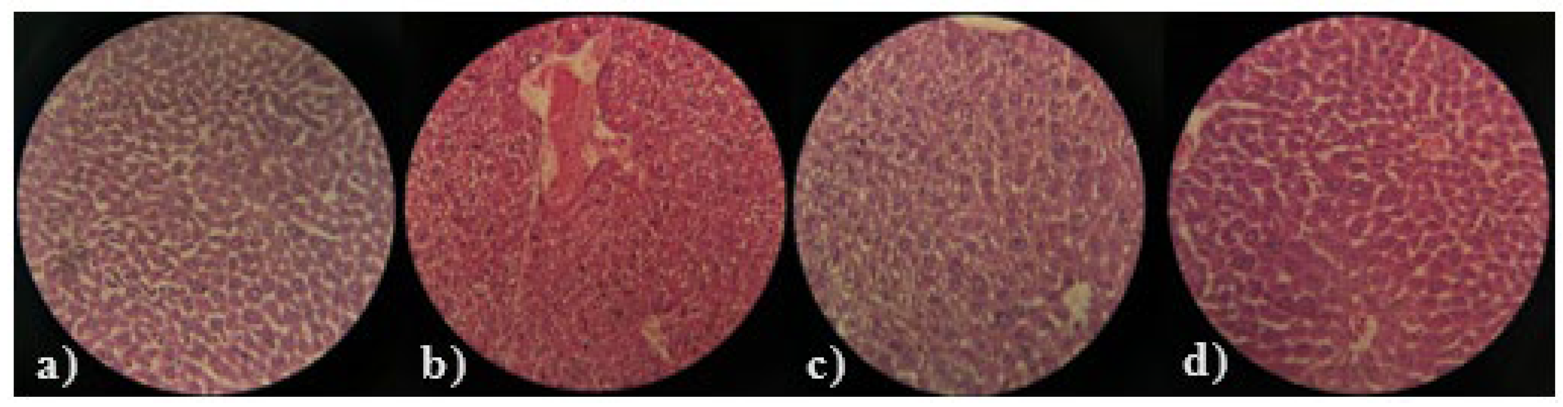 Medicina 61 02130 g004