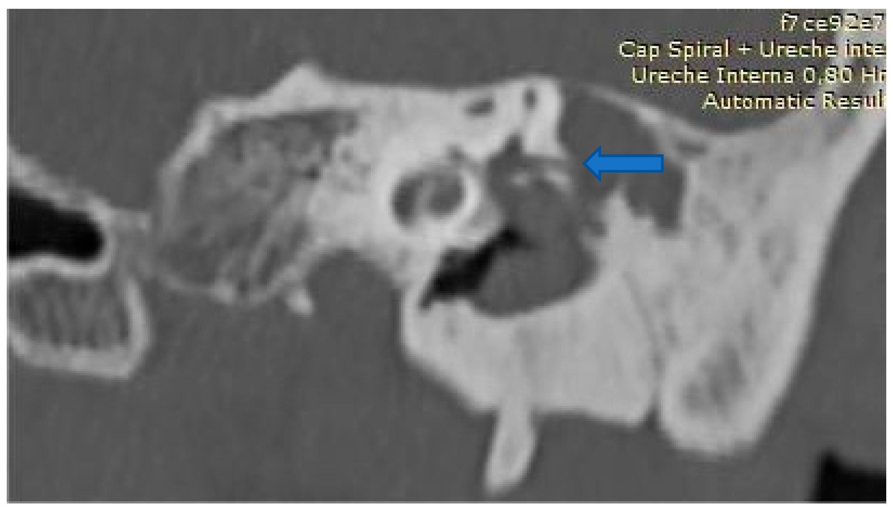 Medicina 61 02144 g002