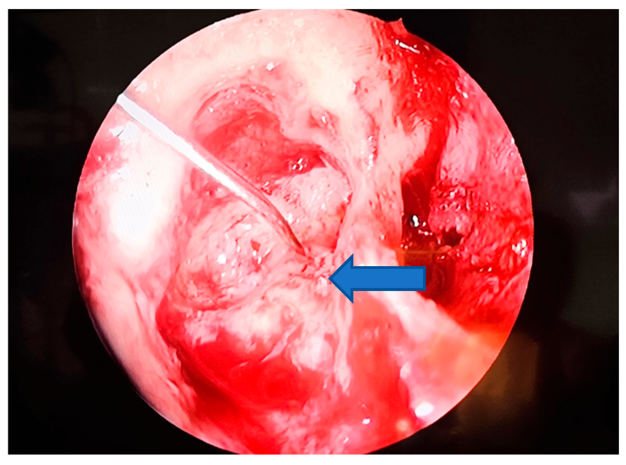 Medicina 61 02144 g004