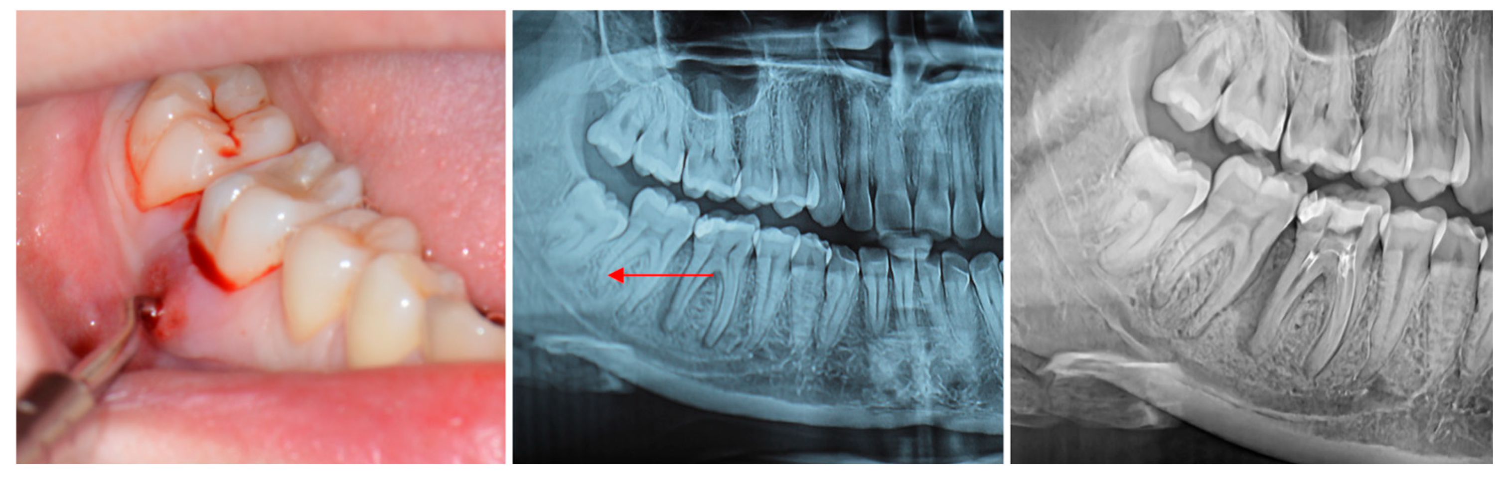 Medicina 61 02157 g001