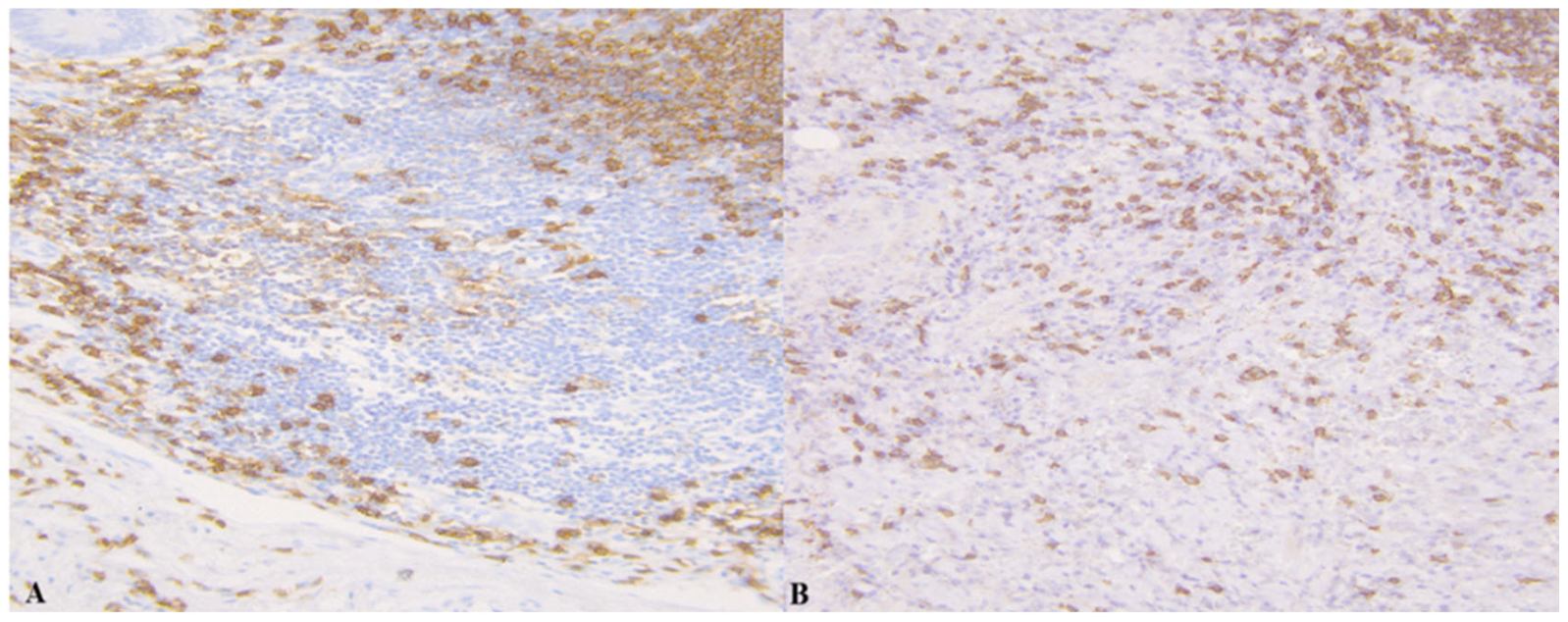 Medicina 61 02161 g003 Medicina 61 02161 g003