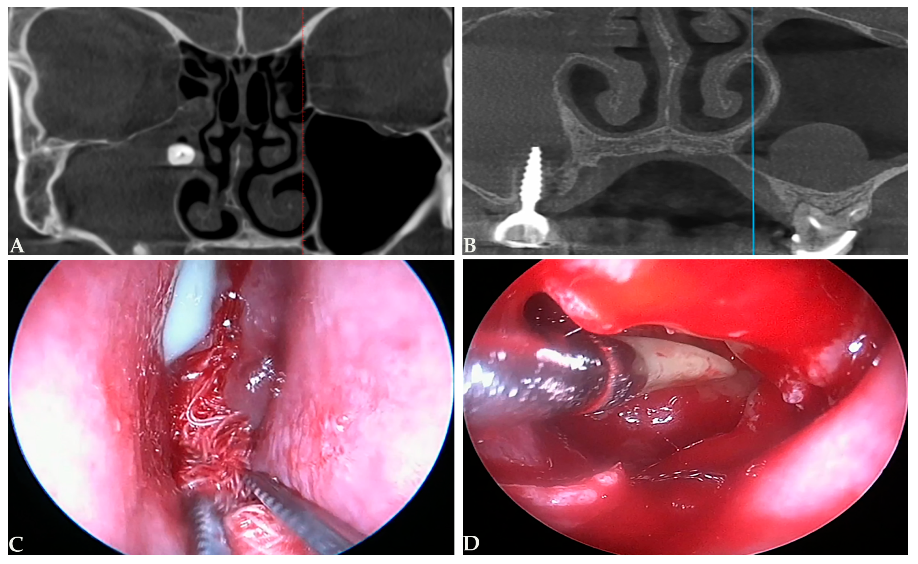 Medicina 61 02175 g001