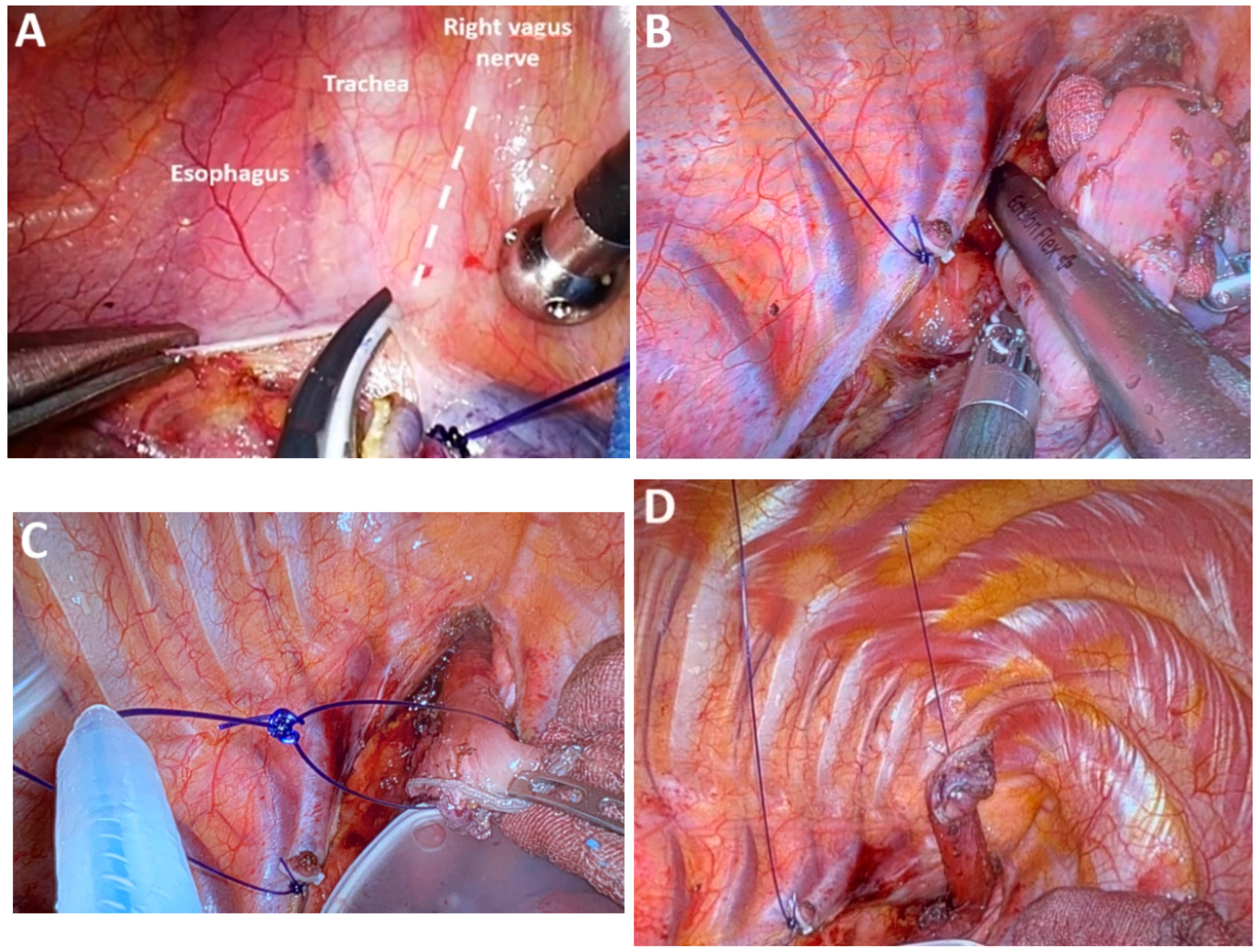 Medicina 61 02176 g007 Medicina 61 02176 g007