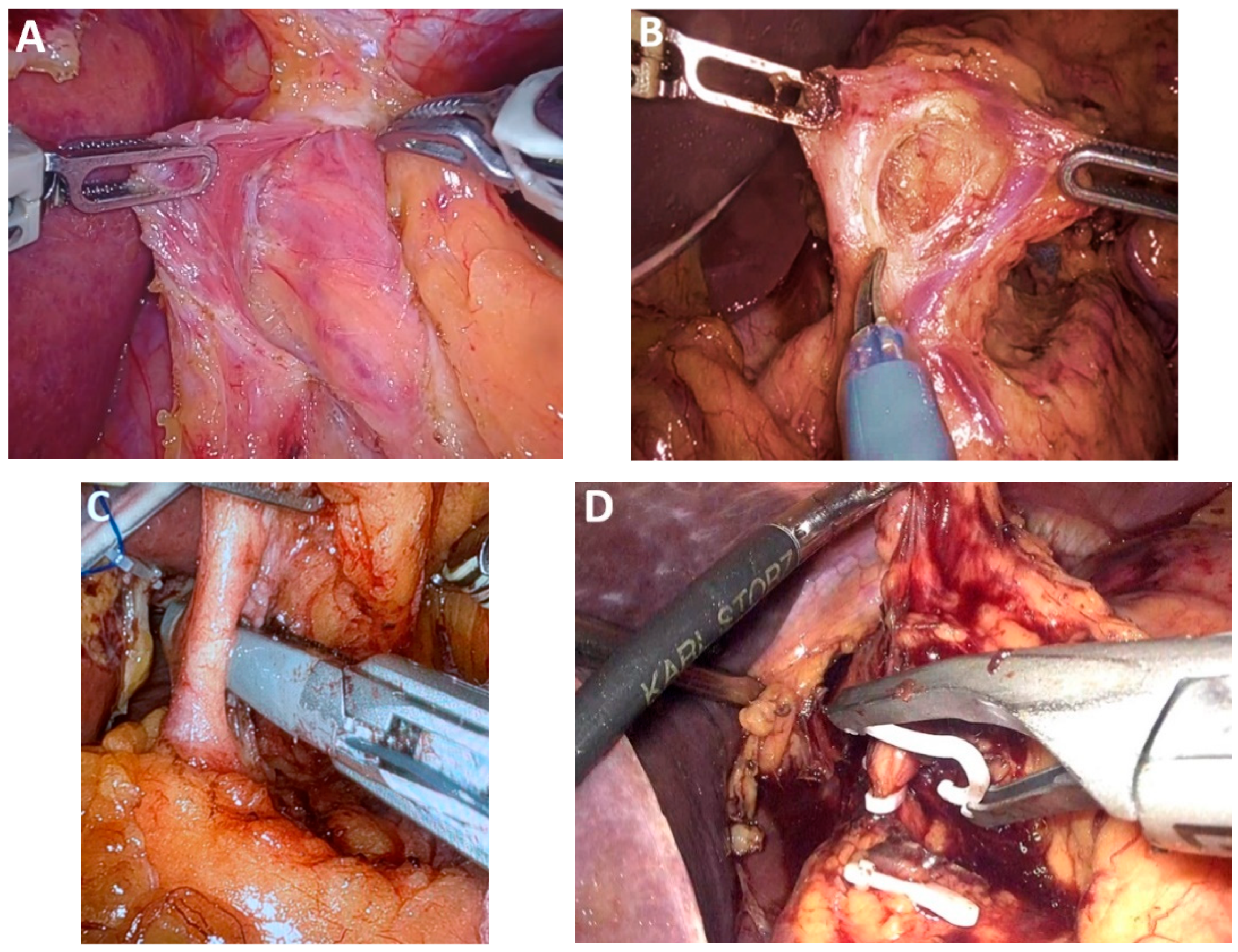 Medicina 61 02176 g014 Medicina 61 02176 g014