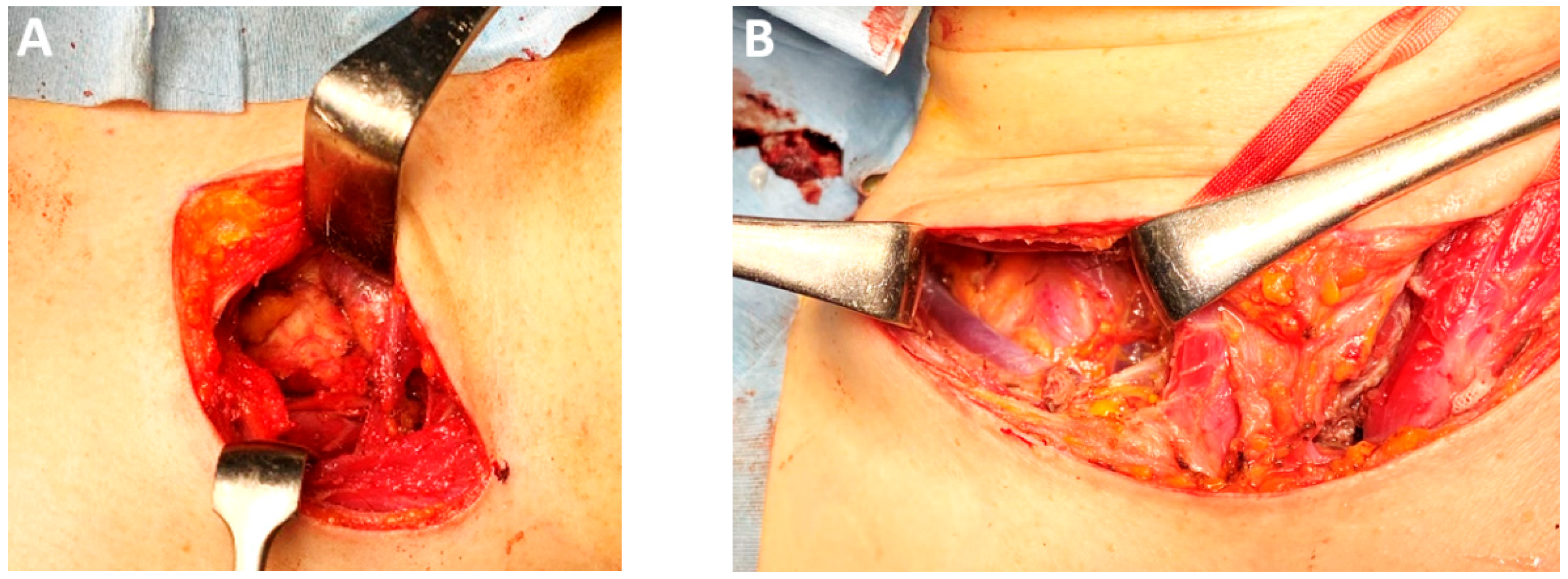 Medicina 61 02176 g015a Medicina 61 02176 g015a