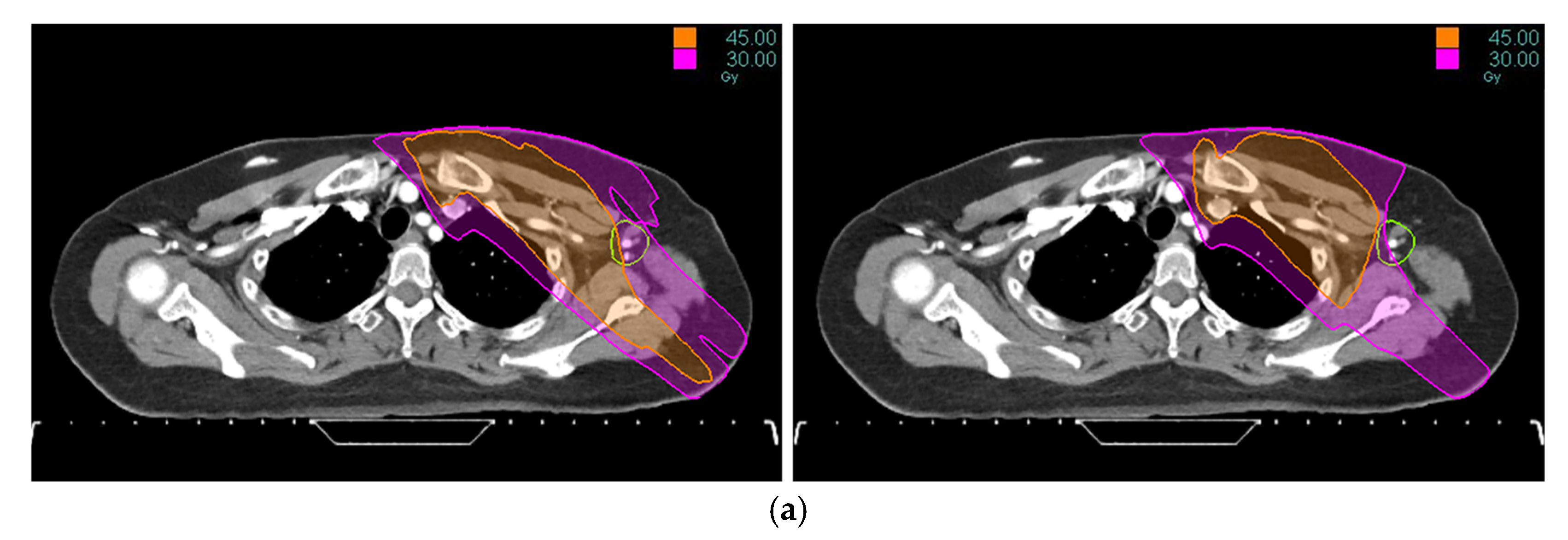 Medicina 61 02177 g001a Medicina 61 02177 g001a