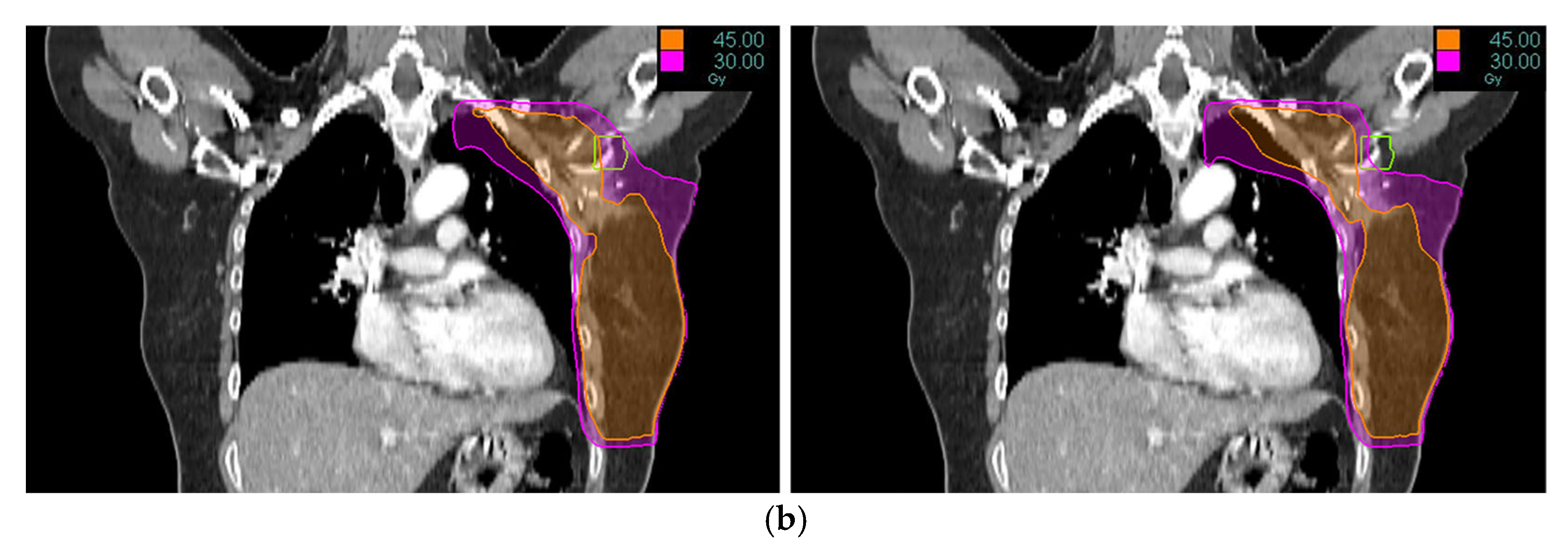 Medicina 61 02177 g001b Medicina 61 02177 g001b